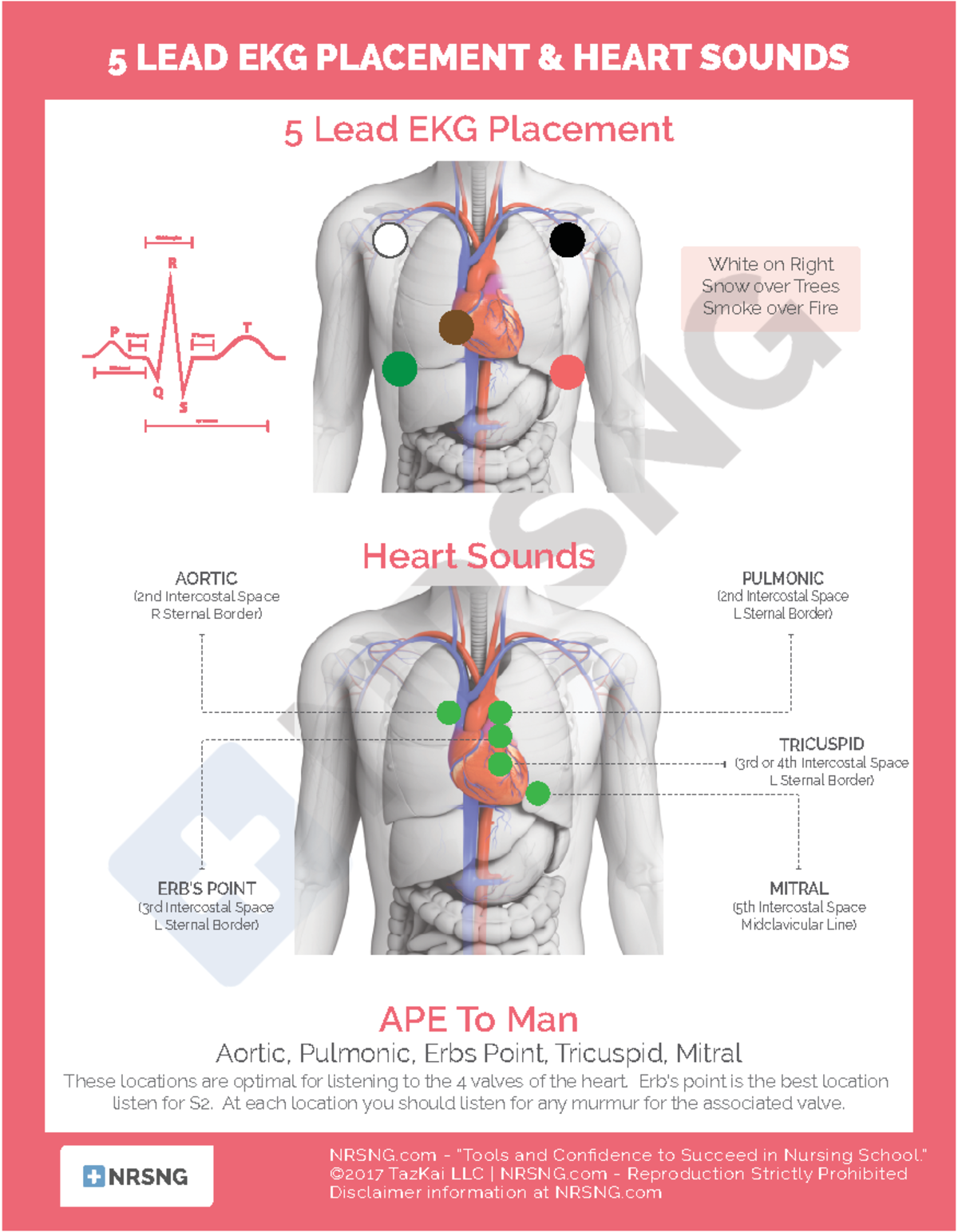 5 Lead Ekg Placement Nrsng Tools And Confidence To Succeed In