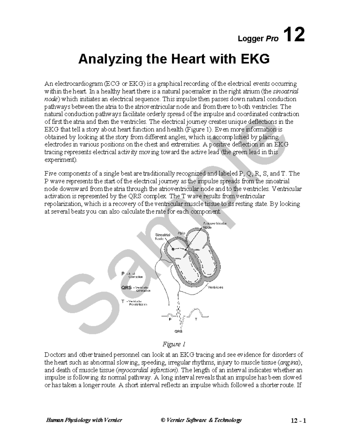 HPA12analyzing heart ekg Human Physiology with Vernier © Vernier
