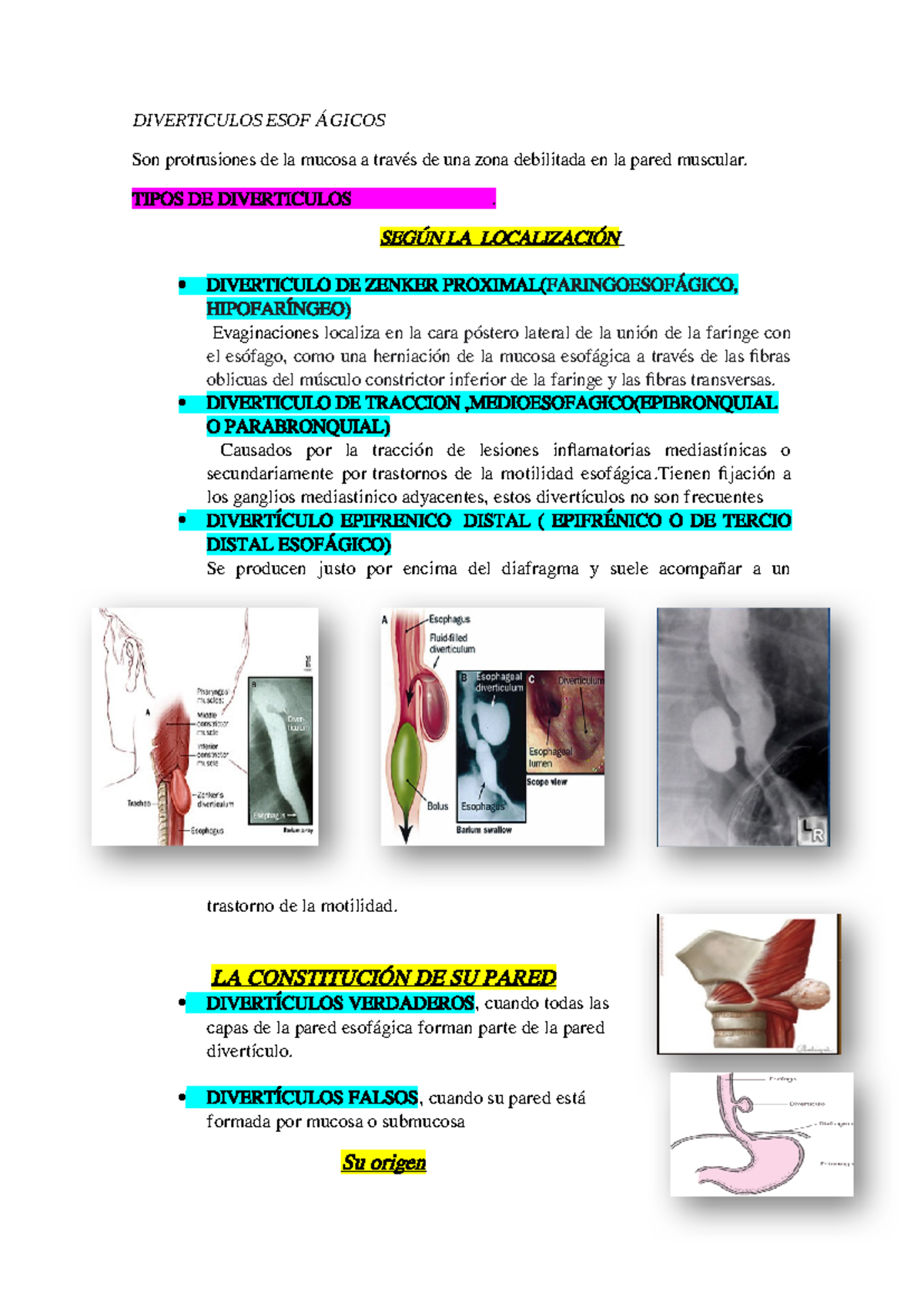 Diverticulos esofágicos - DIVERTICULOS ESOF Á GICOS Son protrusiones de ...