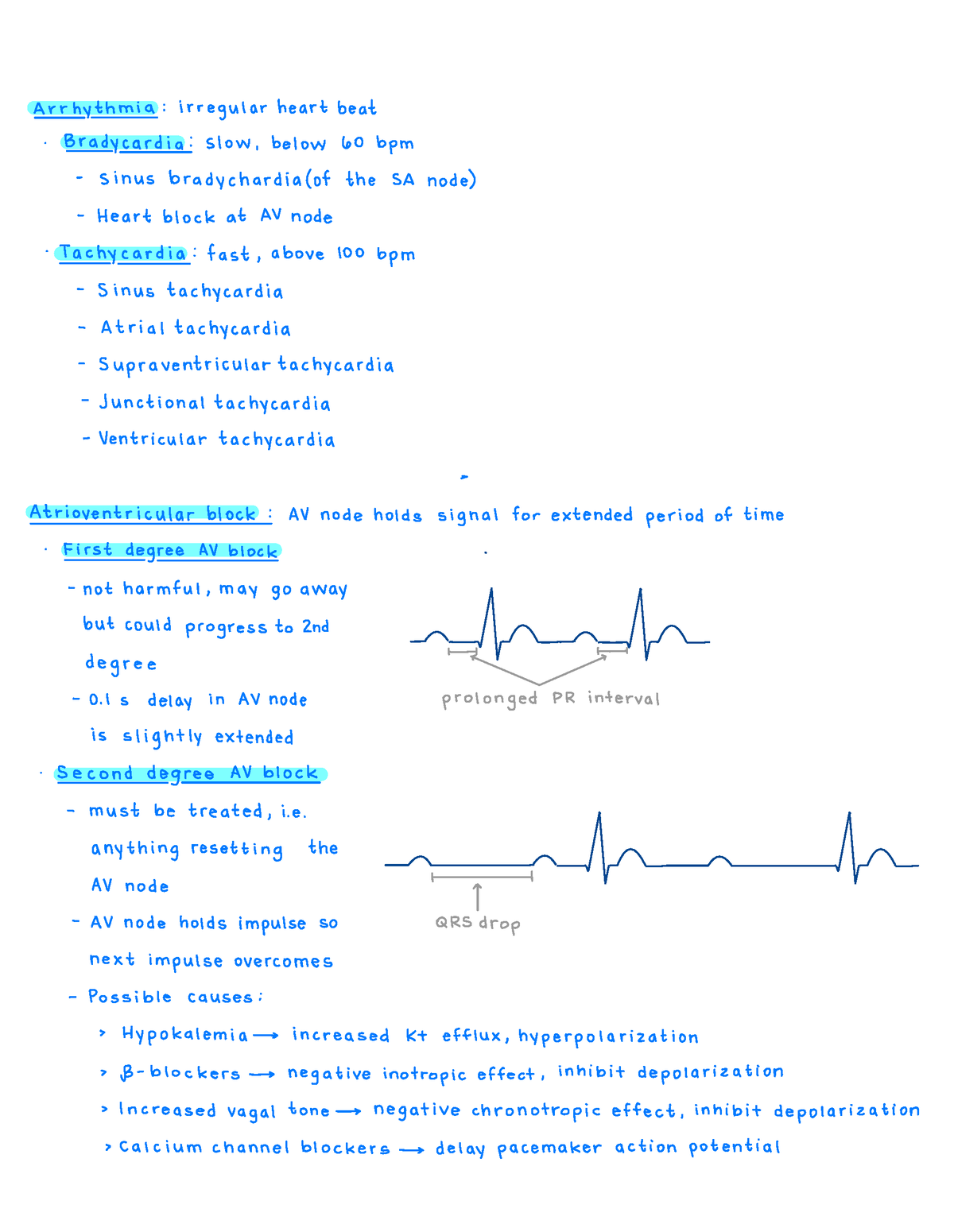 Arrhythmias - Arrhythmia : irregular heart beat . Bradycardia : slow ...