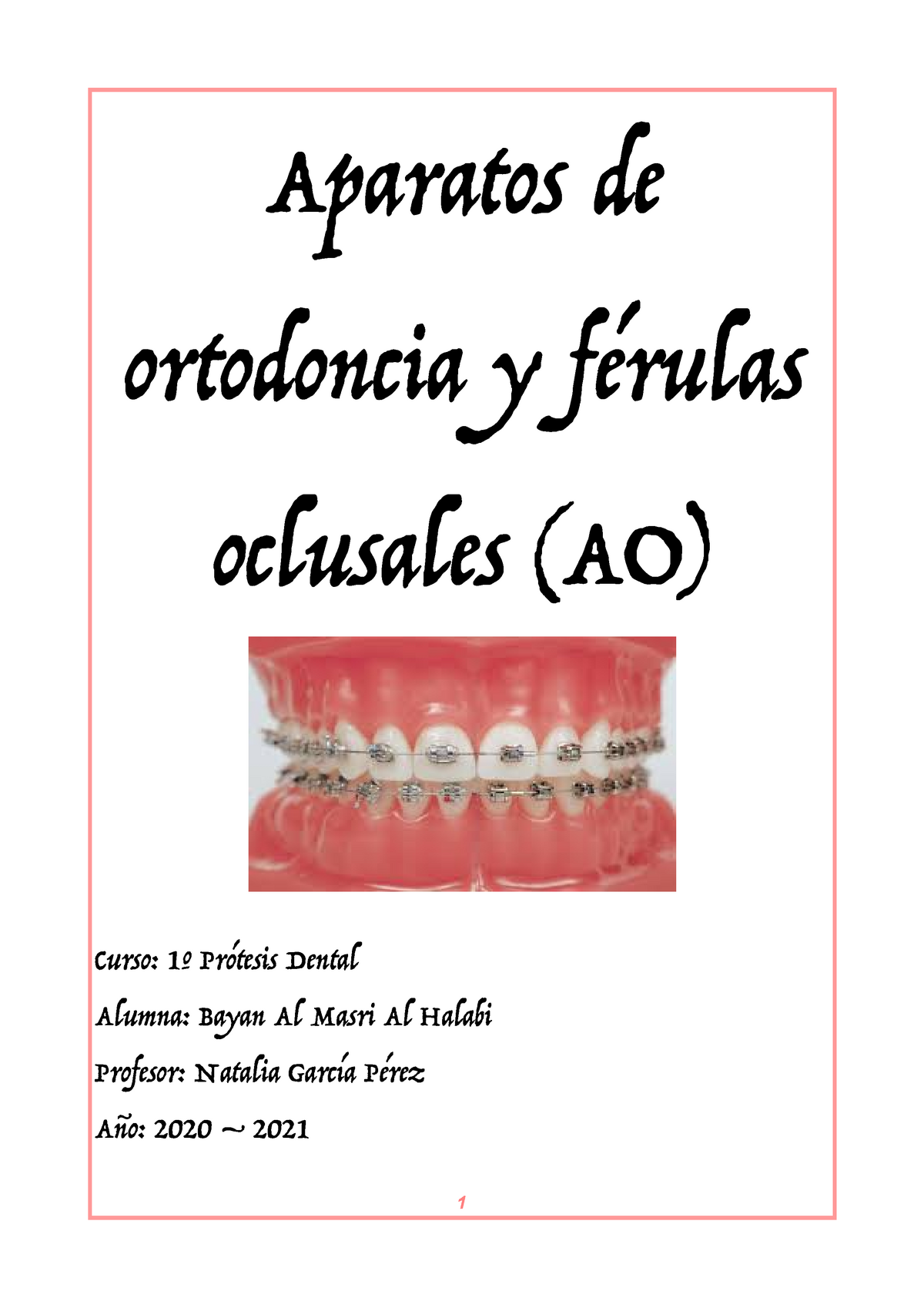 Ortodoncia dental Anterior Muelles rectangulares de torque Grande Medio  Pequeño