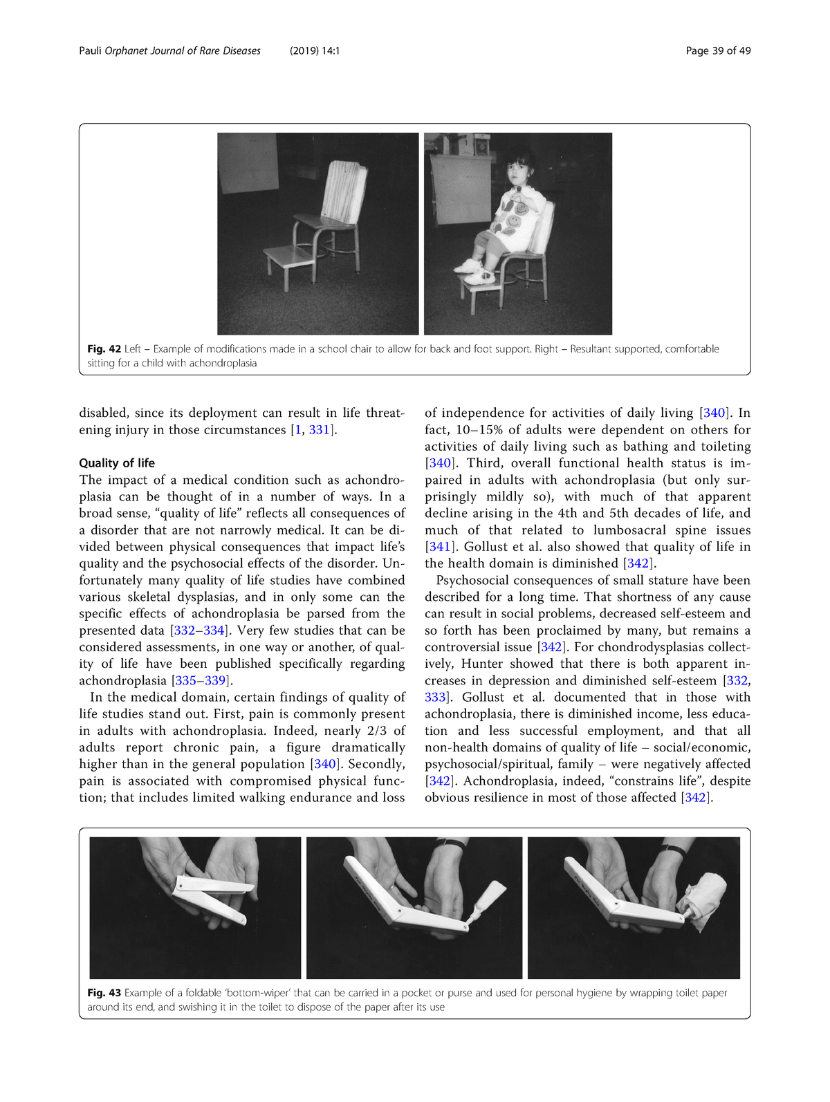 Acondroplasia [39-40] - disabled, since its deployment can result in ...