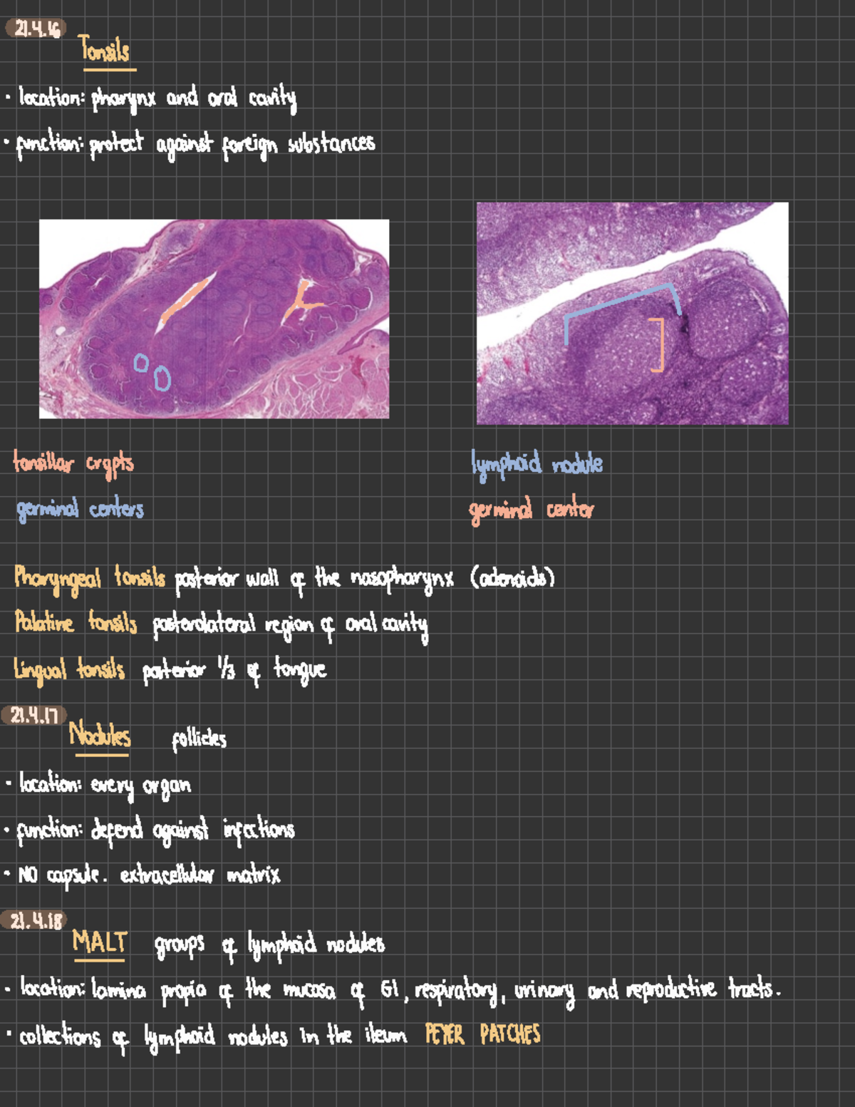 Chapter 21 - Lymphatic System - 21. Tonsils • Location: Pharynx And ...