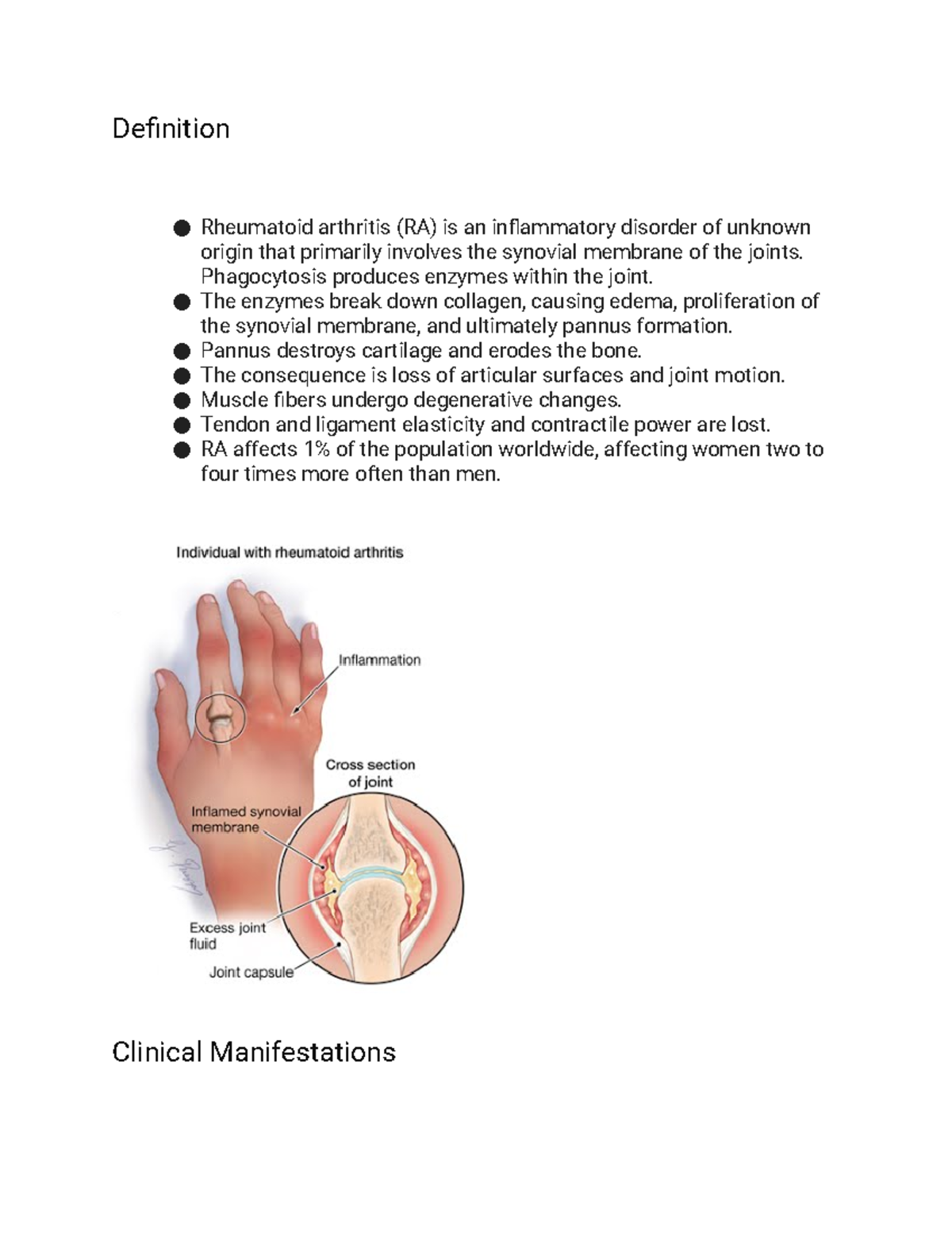 Rheumatoid arthritis MedicalSurgical Nursing II Instructor lecture