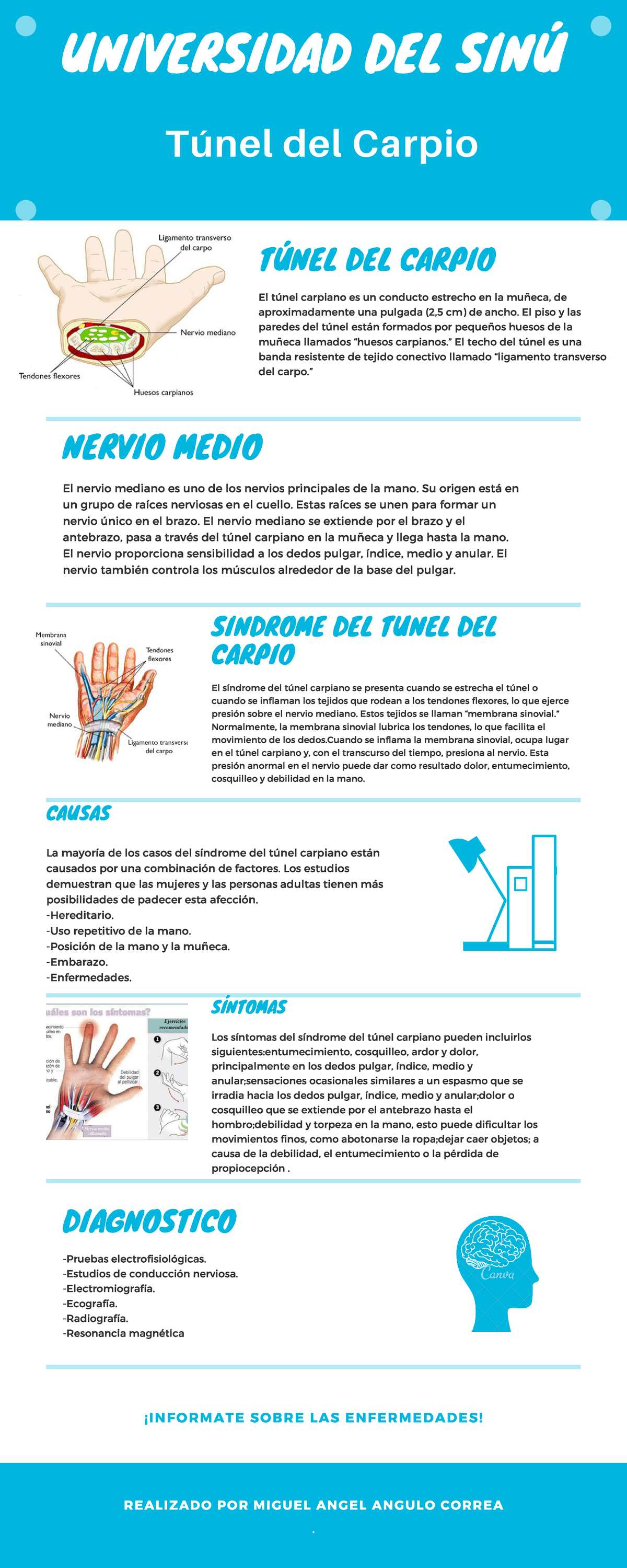 Infografía de Tunel del carpio - StuDocu