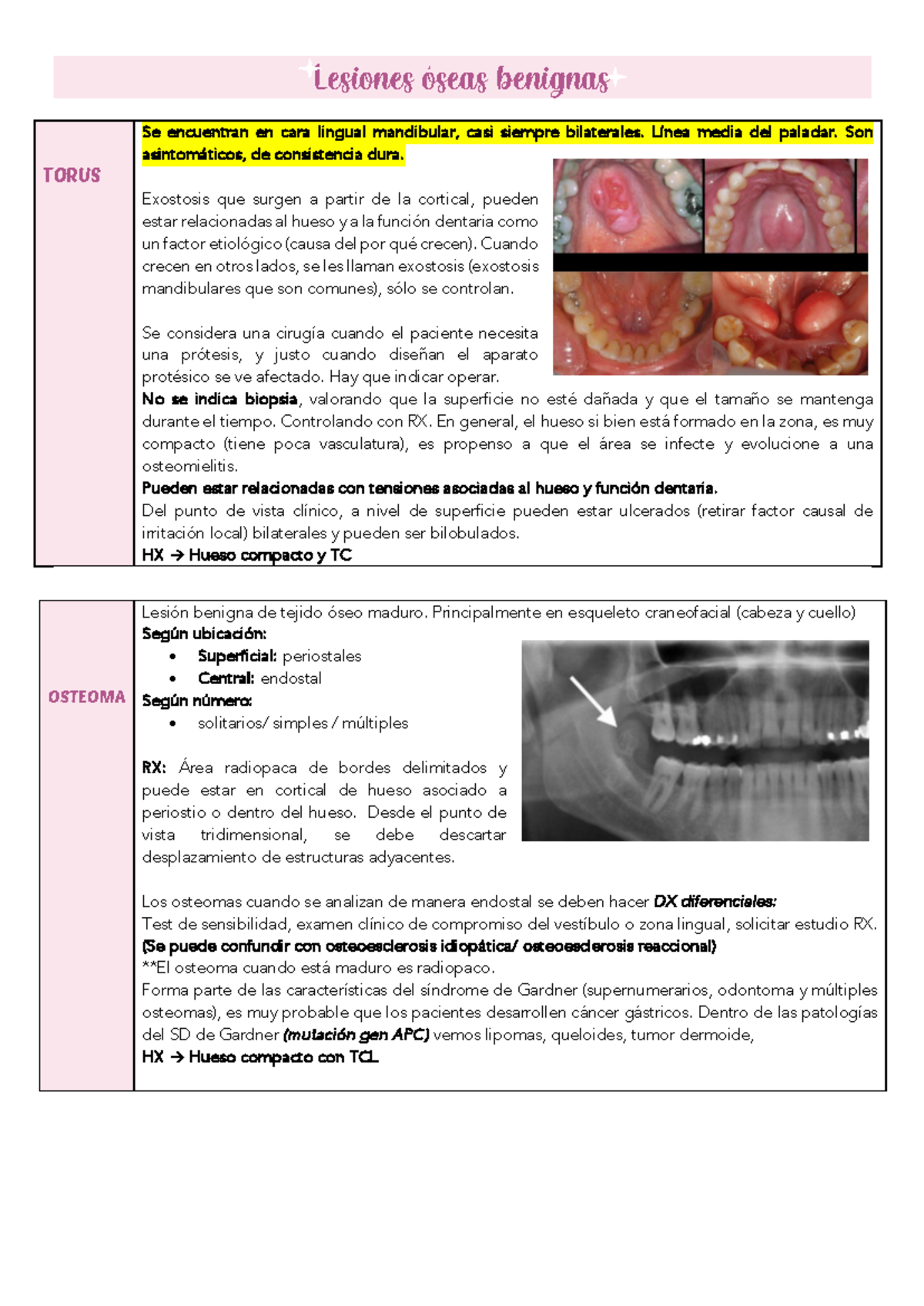 Solemne 4 PatologíA Bucal - Lesiones óseas benignas TORUS Se encuentran ...