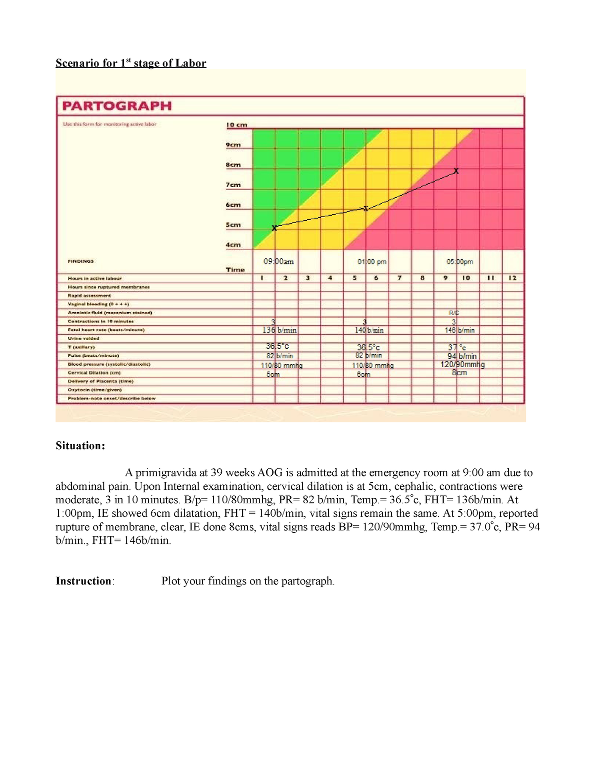 Partograph Nursing Bsu Studocu