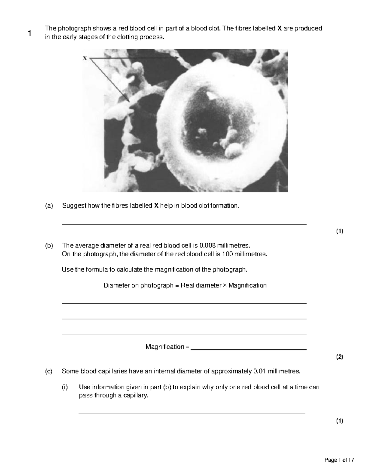 Set 3 Cell Biology Grades 7 9 - The photograph shows a red blood cell ...