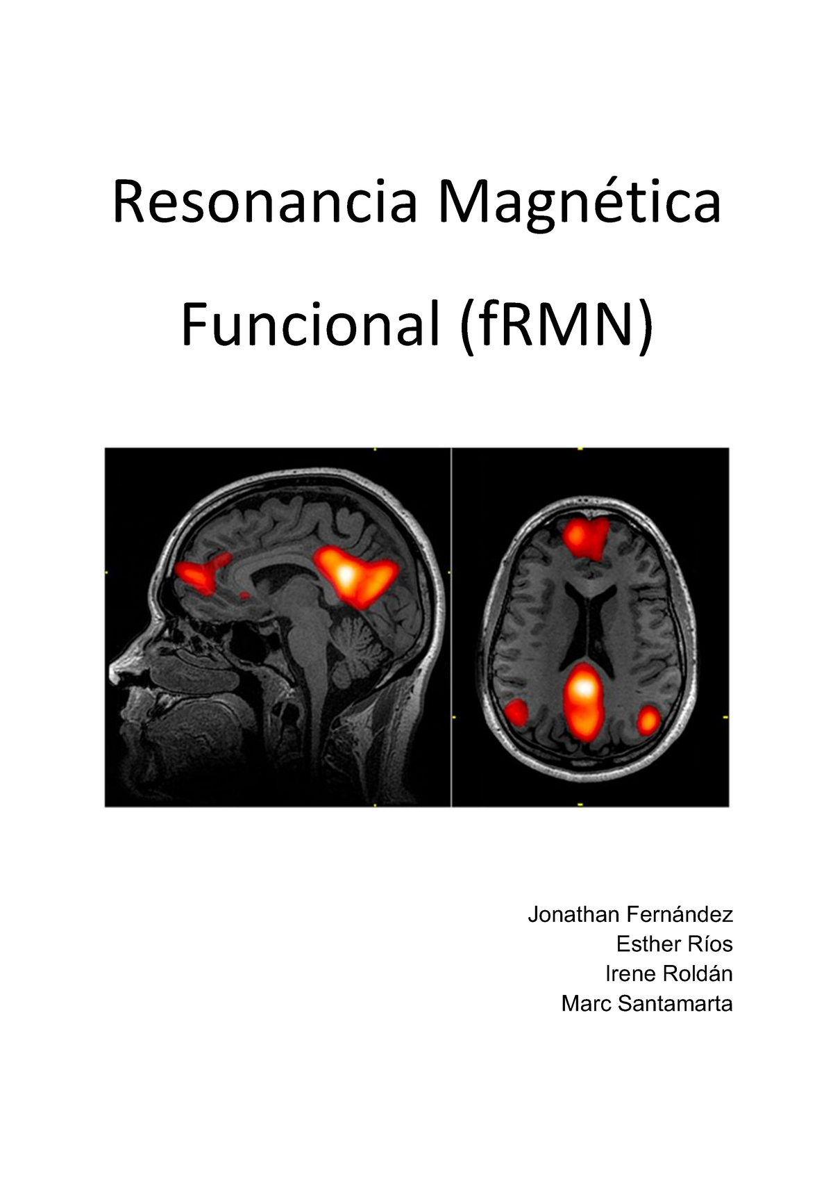 APUNTES RESONANCIA MAGNETICA FUNCIONAL, Aplicación - Aplicació De La ...