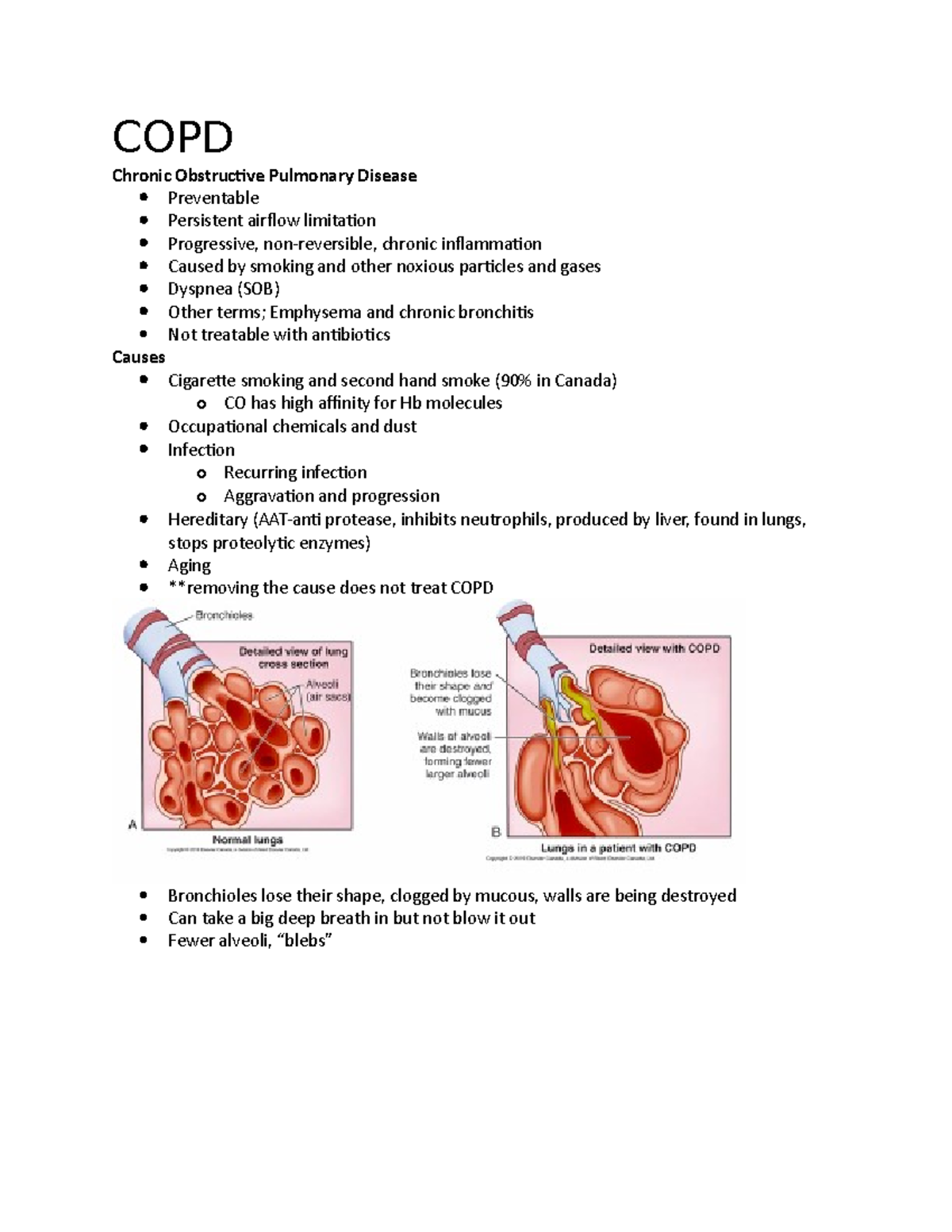 Week 7-COPD - Lecture notes 7 - COPD Chronic Obstructive Pulmonary ...