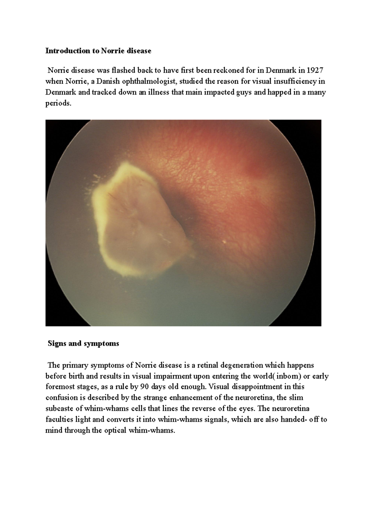 Causes And Signs And Symptoms Of Norrie Disease 1 Introduction To