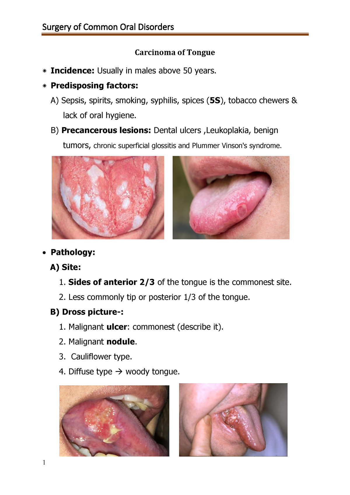 Surgery Oral cavity - Carcinoma of Tongue ⁕ Incidence: Usually in males ...