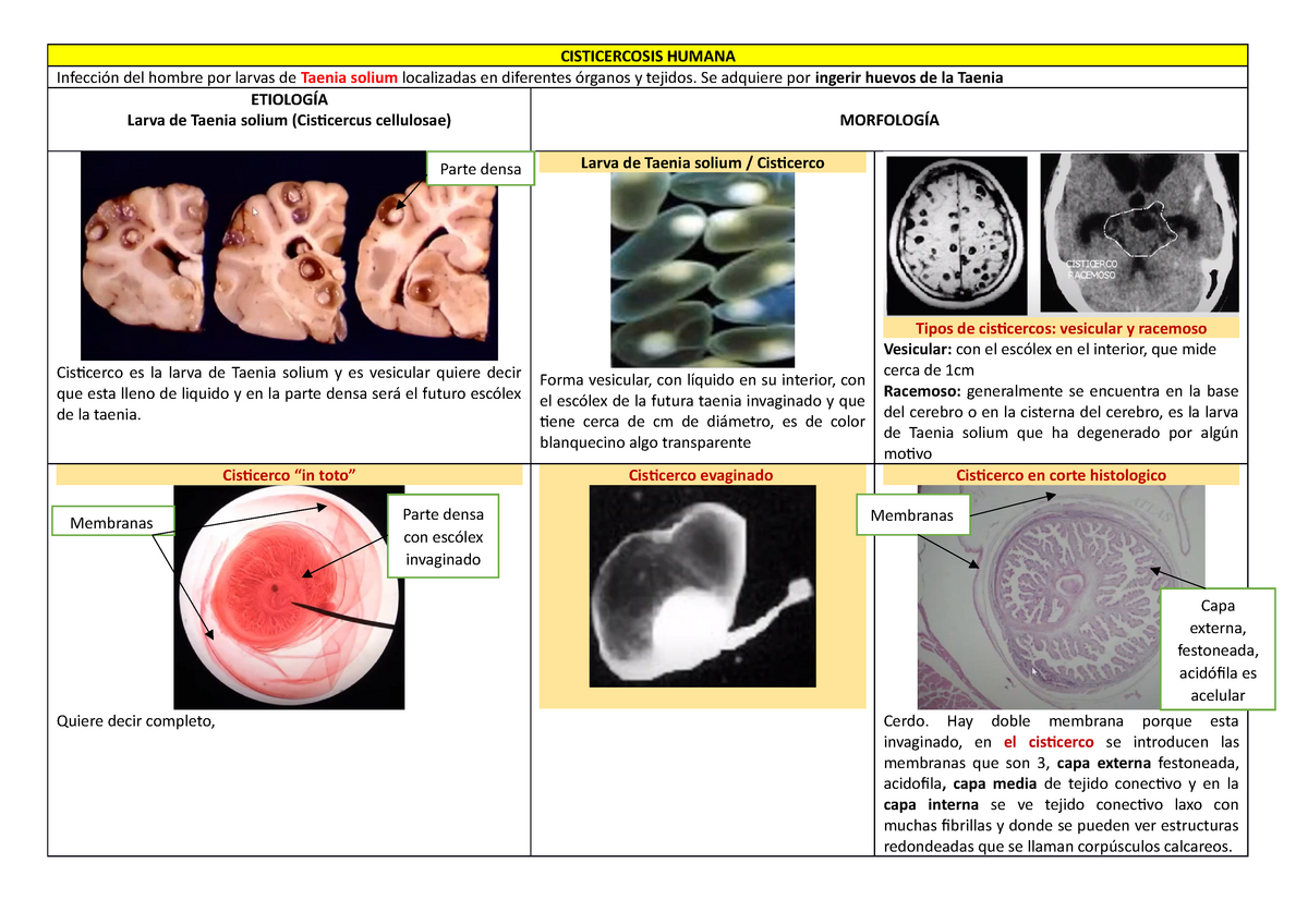 cisticerco de la tenia solium