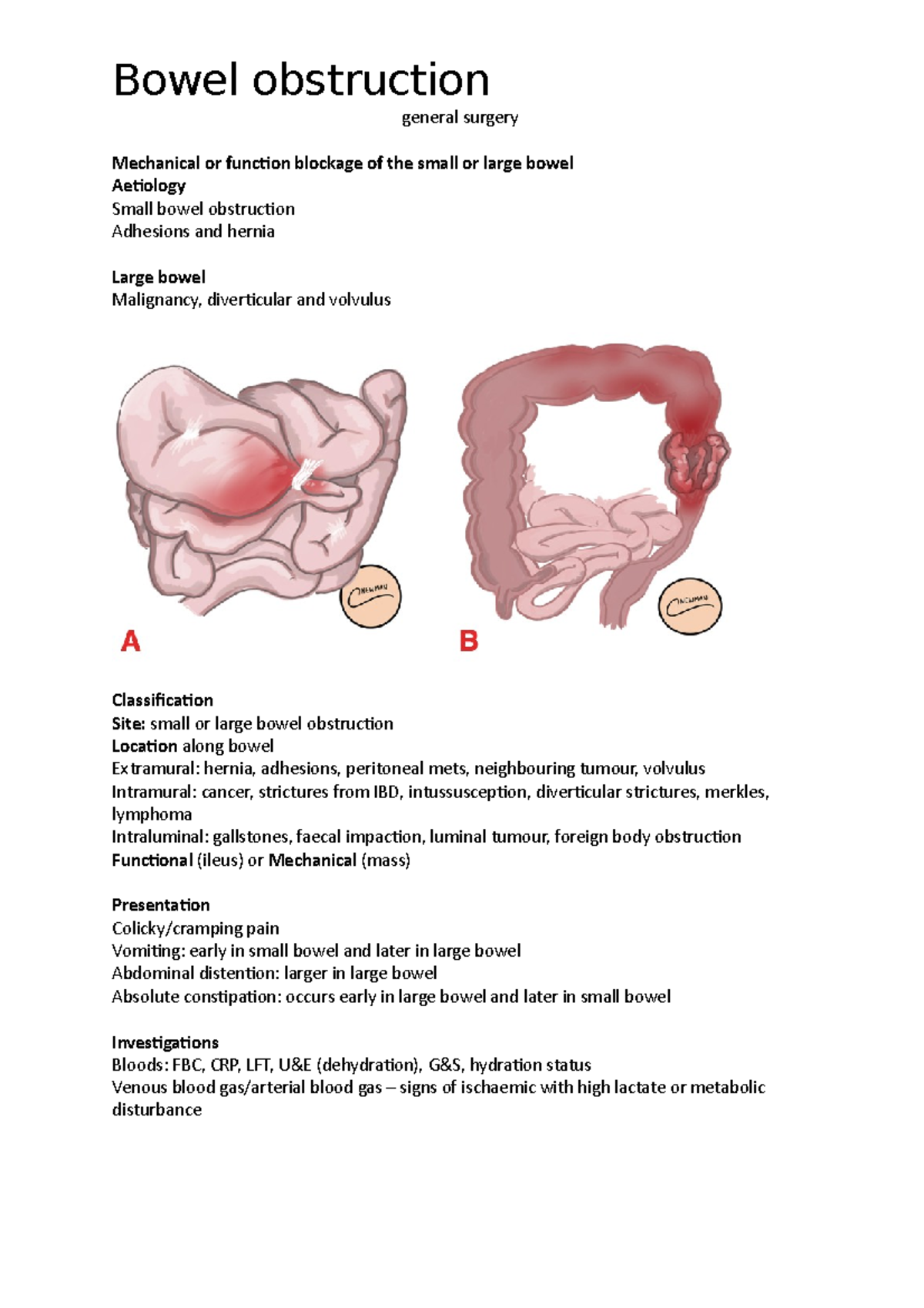 Bowel obstruction Bowel obstruction general surgery Mechanical or