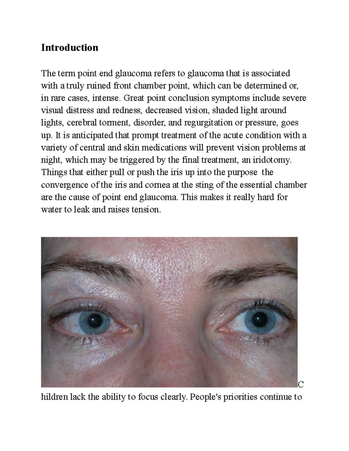 Anisocoria and effects Introduction The term point end