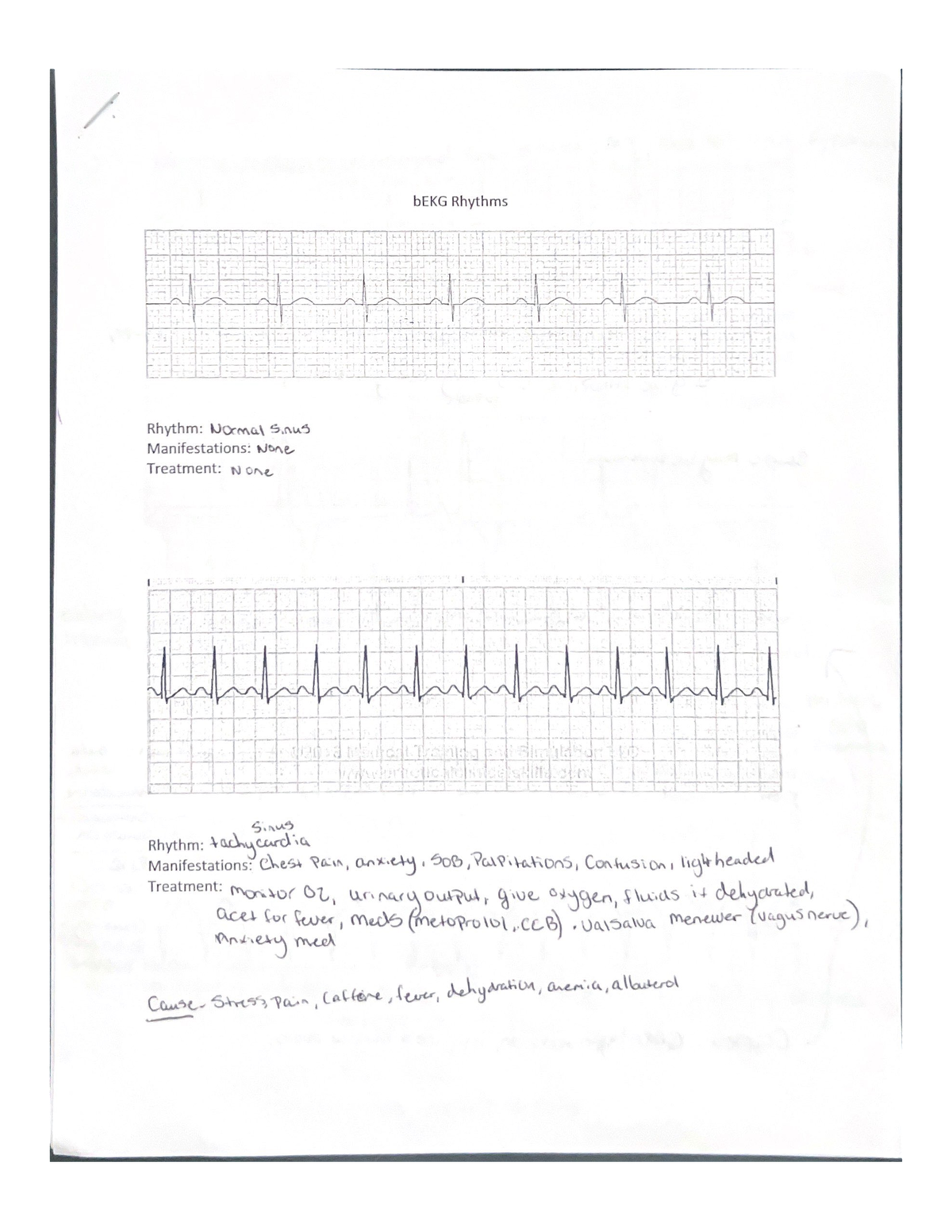 B EKG Rhythms - EKG - NURS 343 - Studocu