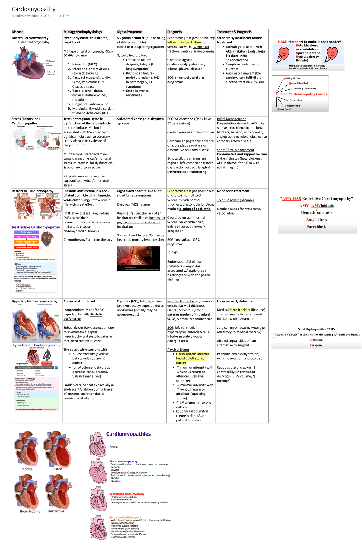 Cardiomyopathy - Postviral myocarditis, HIV, Lyme, Parvovirus B19 ...