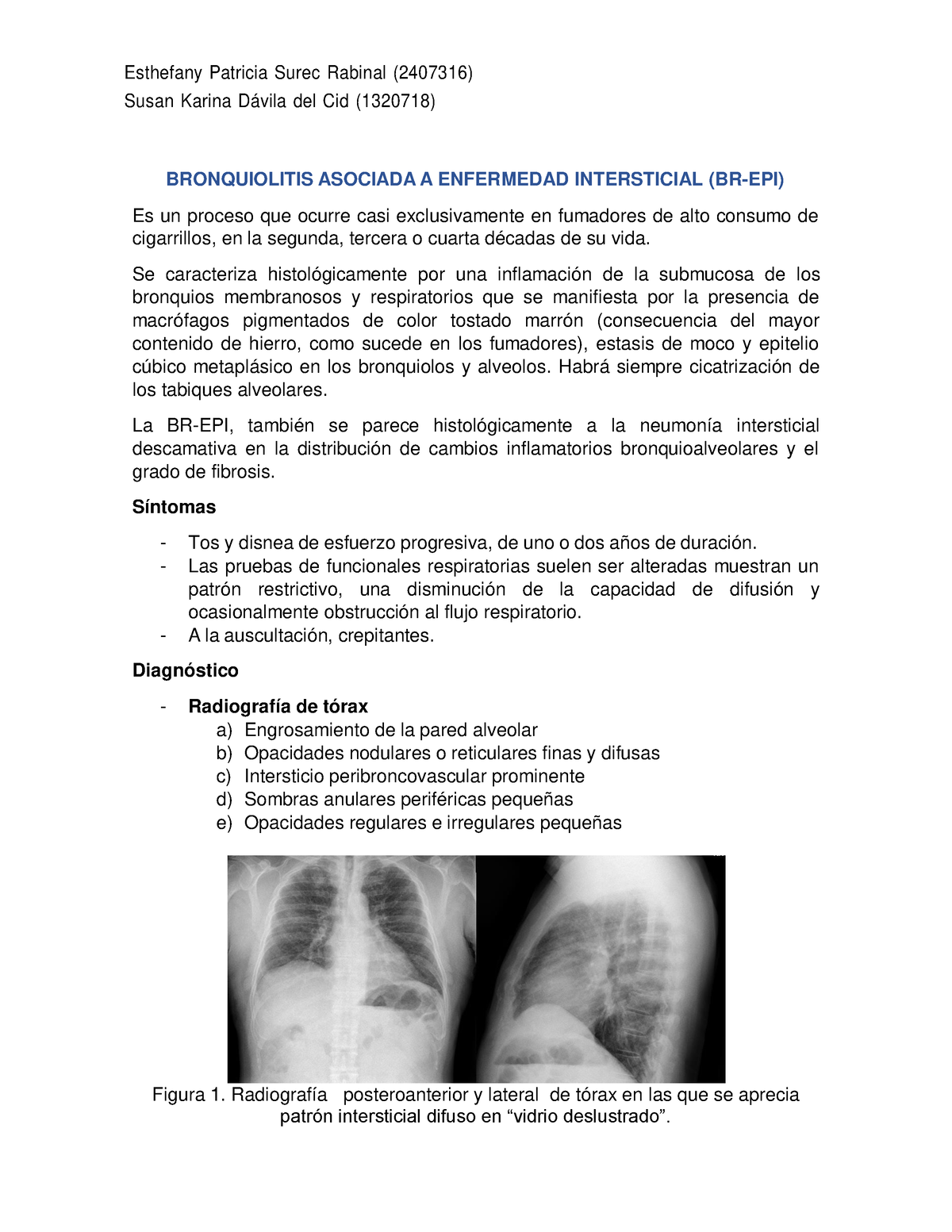 Bronquiolitis Asociada A Enfermedad Intersticial (BR-EPI) Pdf ...