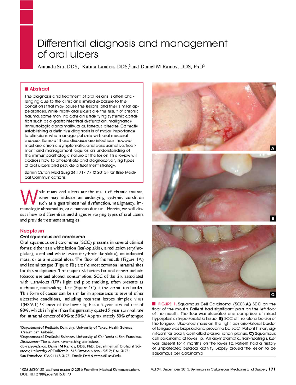 scms-v34i4-differential-diagnosis-and-management-of-oral-ulcers