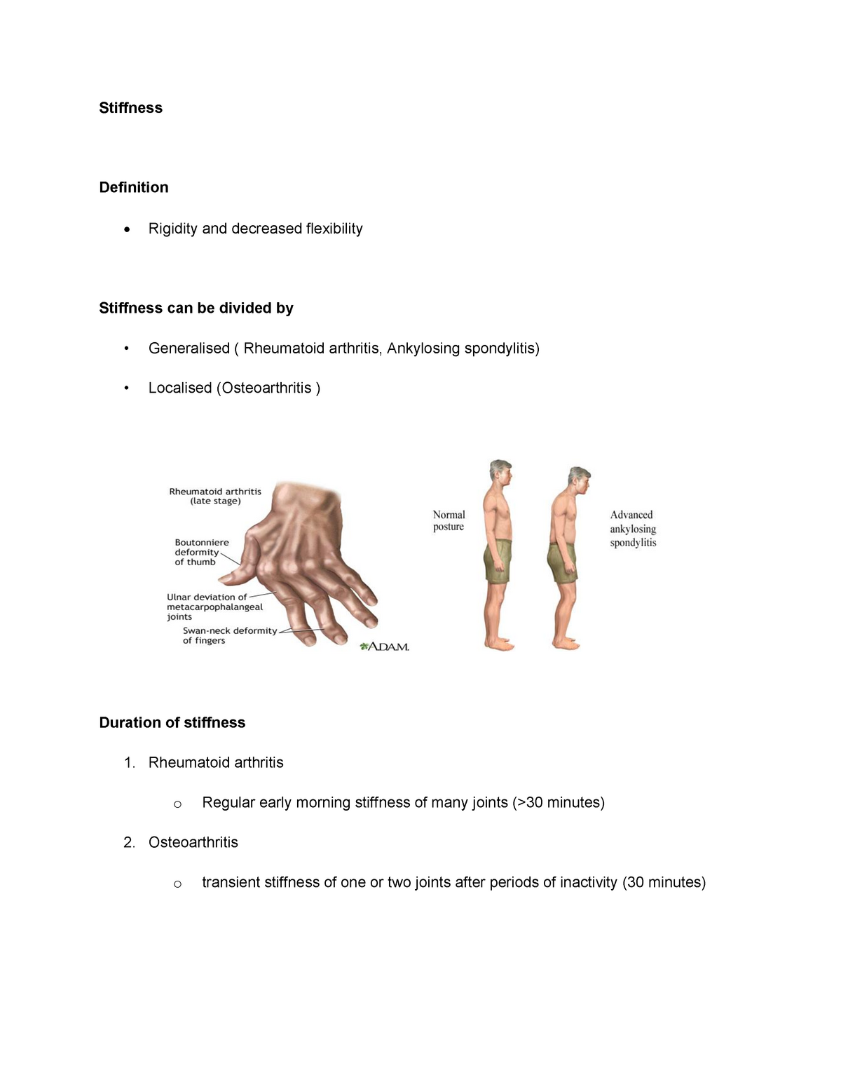 Stiffness & Functional Loss - Stiffness Definition Rigidity and ...