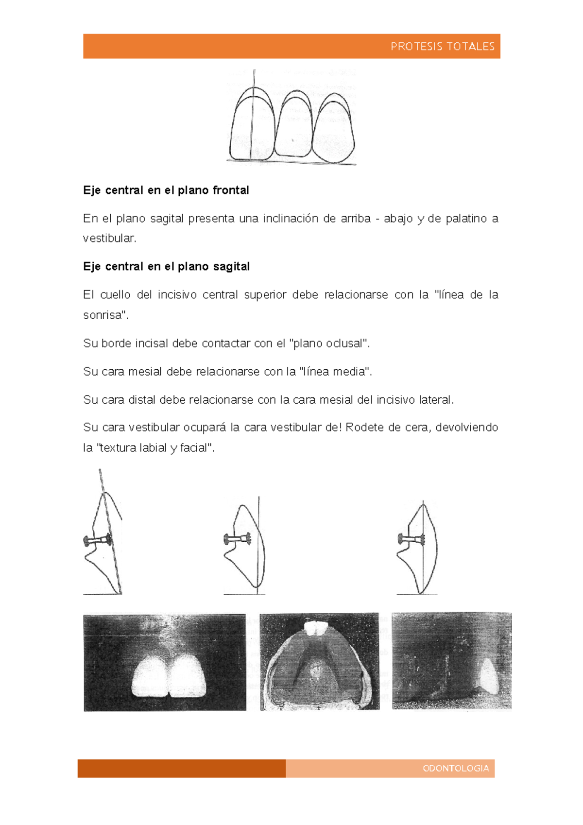 Enfilado de dientes superiores - Eje central en el plano frontal En el ...