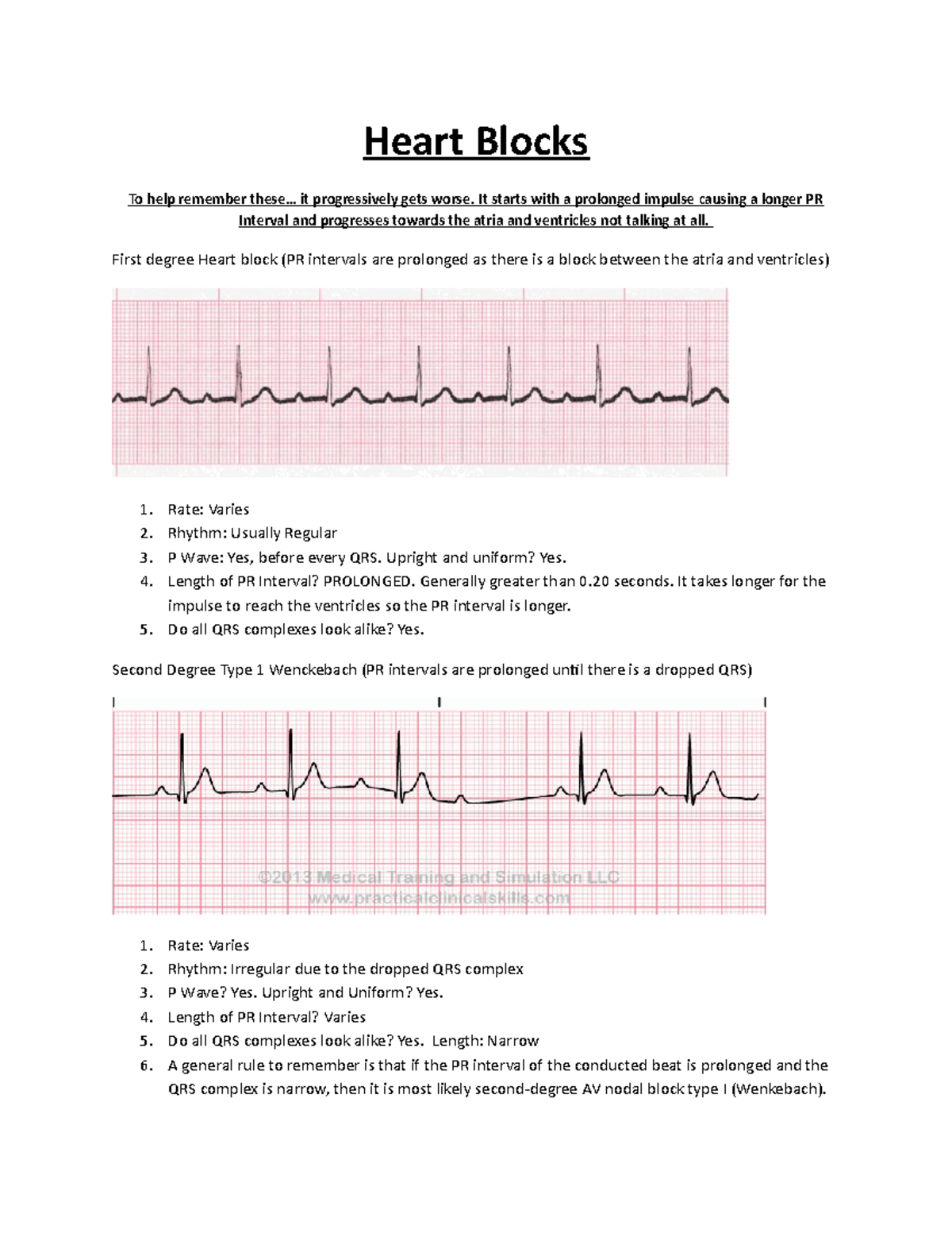 EKG Heart Blocks worksheet to help - Heart Blocks To help remember ...