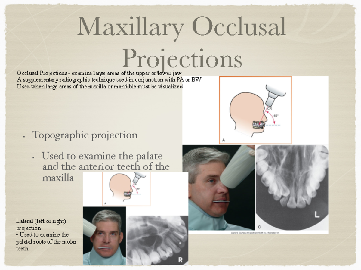 Lecture 10 Mrs. Cherney. Fall 2022 Maxillary Occlusal Projections