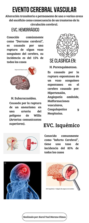 Tarea sistema muscular ASL - UVM Universidad del Valle de México CAMPUS ...