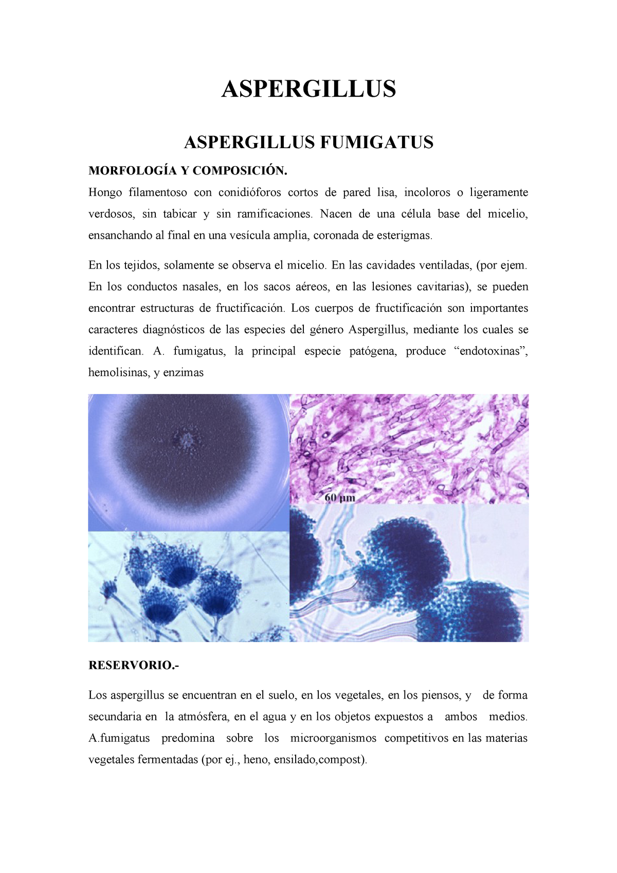 Aspergillus - asp - Veterinaria - UNPRG ASPERGILLUS ...