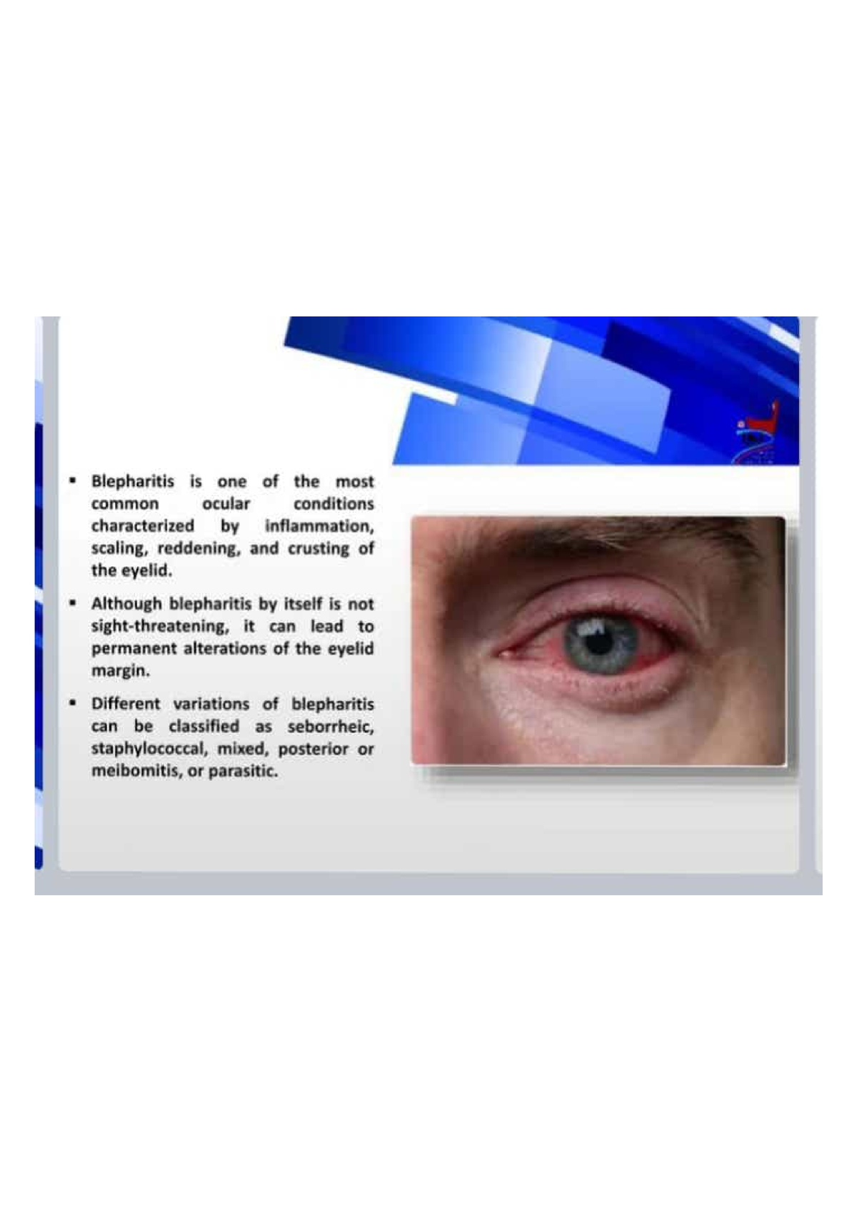 Blepharitis - Detailed note about eye lid disorder - Bsc.optometry ...