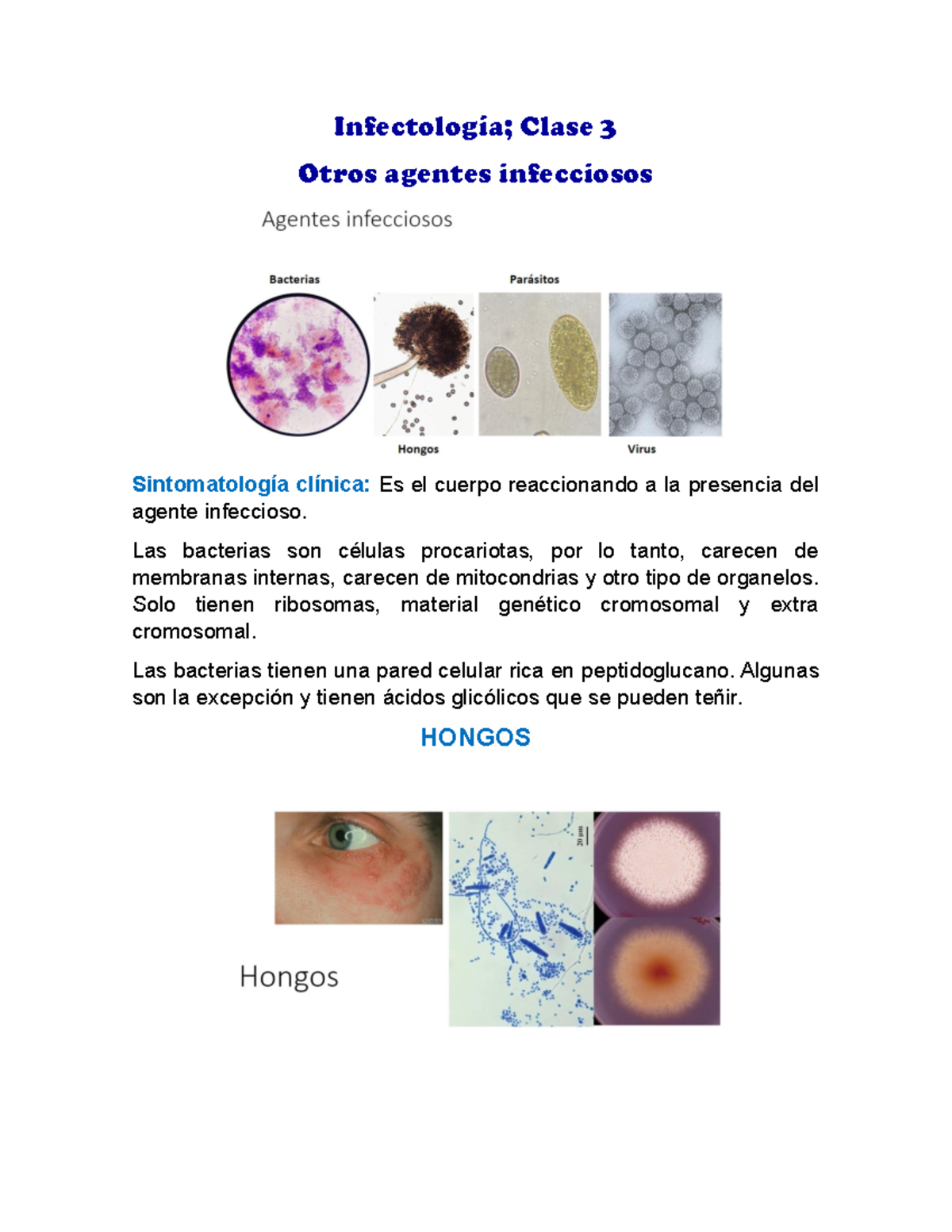 Clase 03. Otros agentes infecciosos - Infectología; Clase 3 Otros ...
