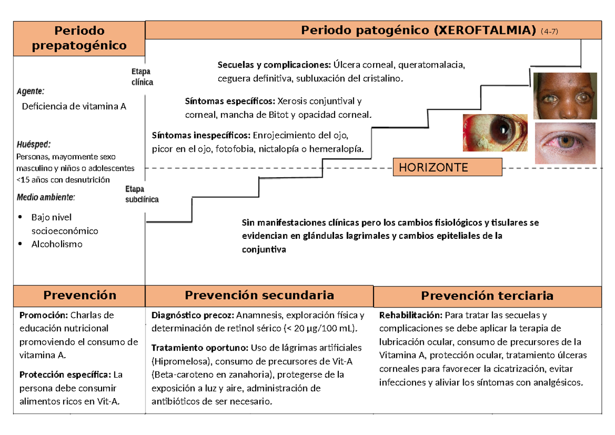 Xeroftalmia - Historia natural de la enfermedad - Deficiencia de ...