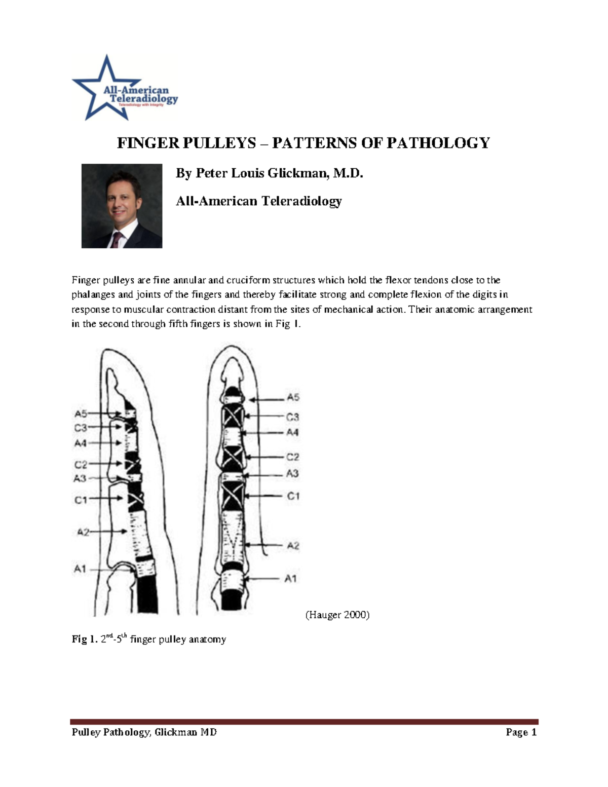 Annular pulley FINGER PULLEYS PATTERNS OF PATHOLOGY By Peter Louis
