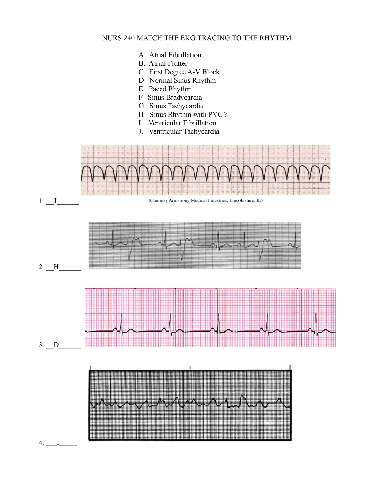 NURS 240 Match THE EKG Tracing TO THE Rhythm - NURS240 - NURS 240 MATCH ...