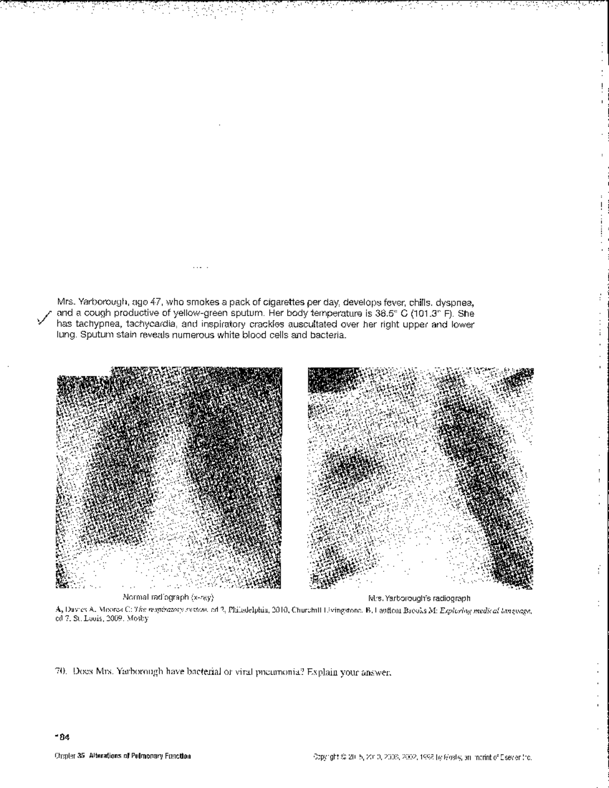 Respiratory Case - Case Study - NUR469 - Studocu