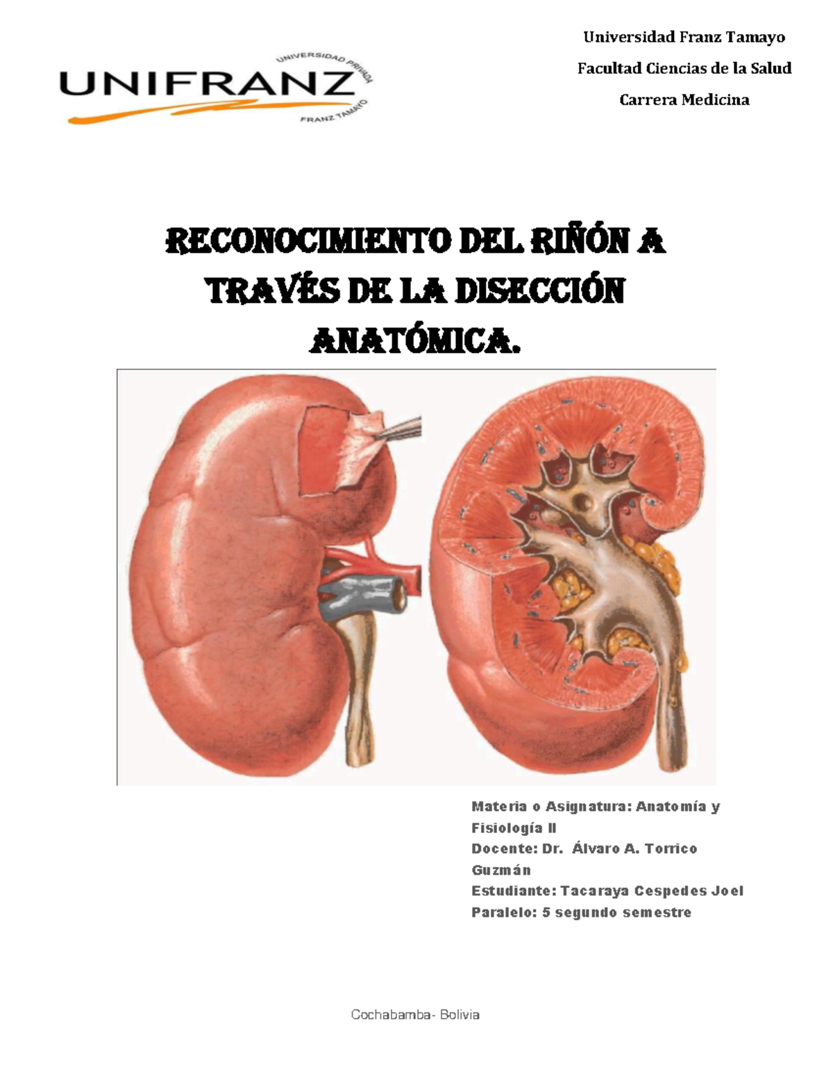 Diseccion riñon HITO 5 - 2° Semestre PDF - Universidad Franz Tamayo ...