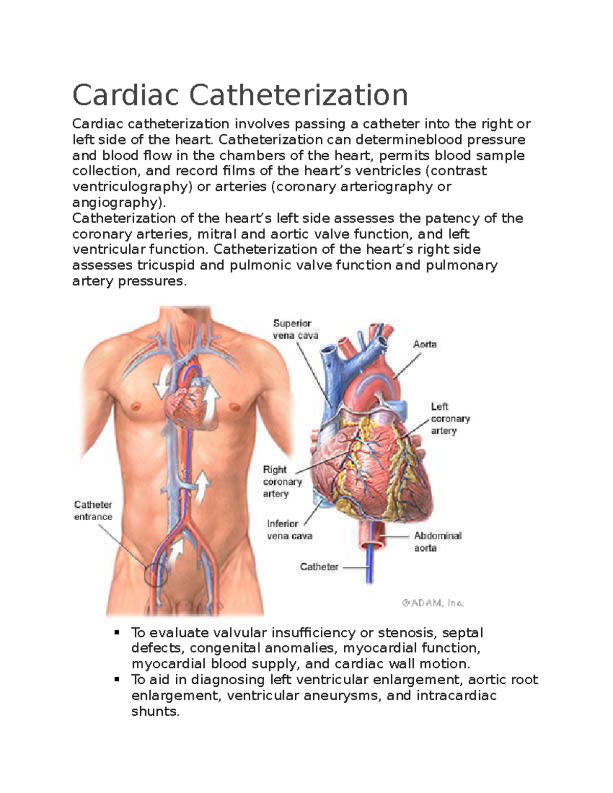 Cardiac Catheterization - Cardiac Catheterization Cardiac ...