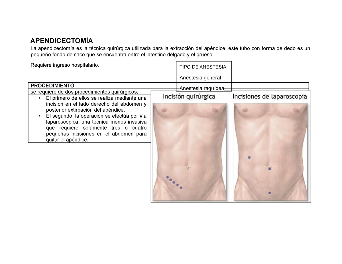 Manual Gastro Apendicectom A La Apendicectom A Es La T Cnica Quir Rgica Utilizada Para La