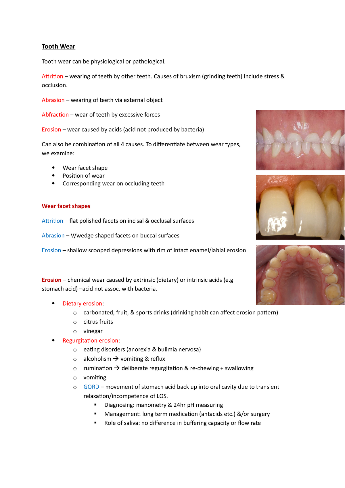 Tooth Wear - Lecture notes 1 - Tooth Wear Tooth wear can be ...