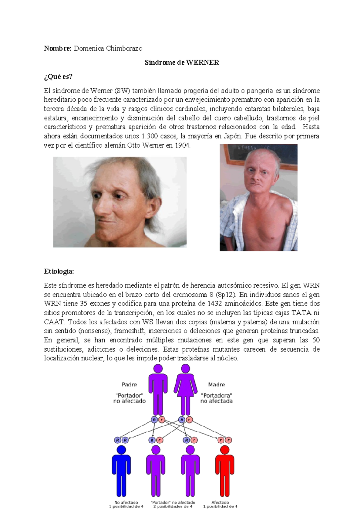 Sindrome de werner - investigación de articulo científico - Nombre ...