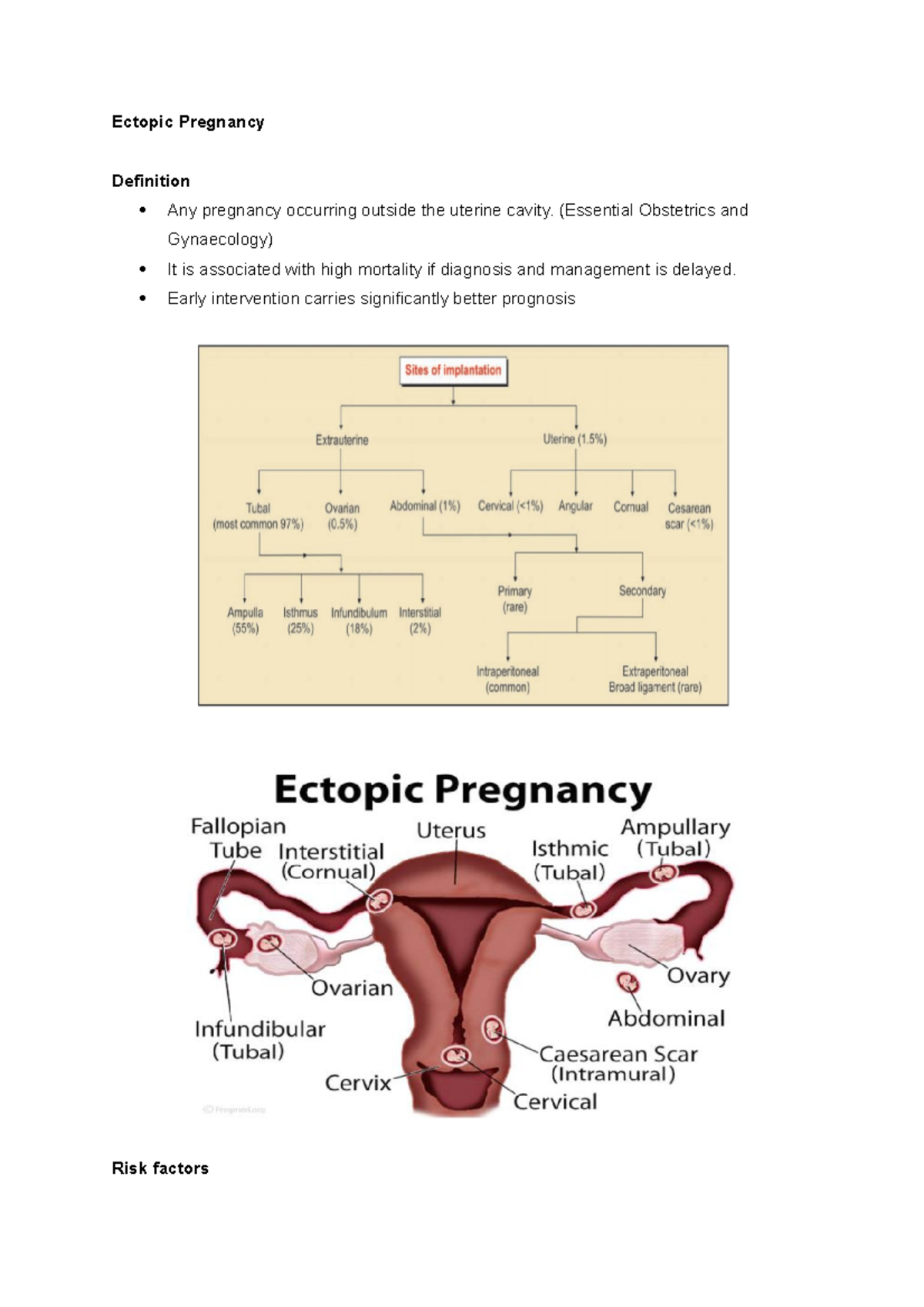 Ectopic - Sem2 Class B - Ectopic Pregnancy Definition Any Pregnancy ...