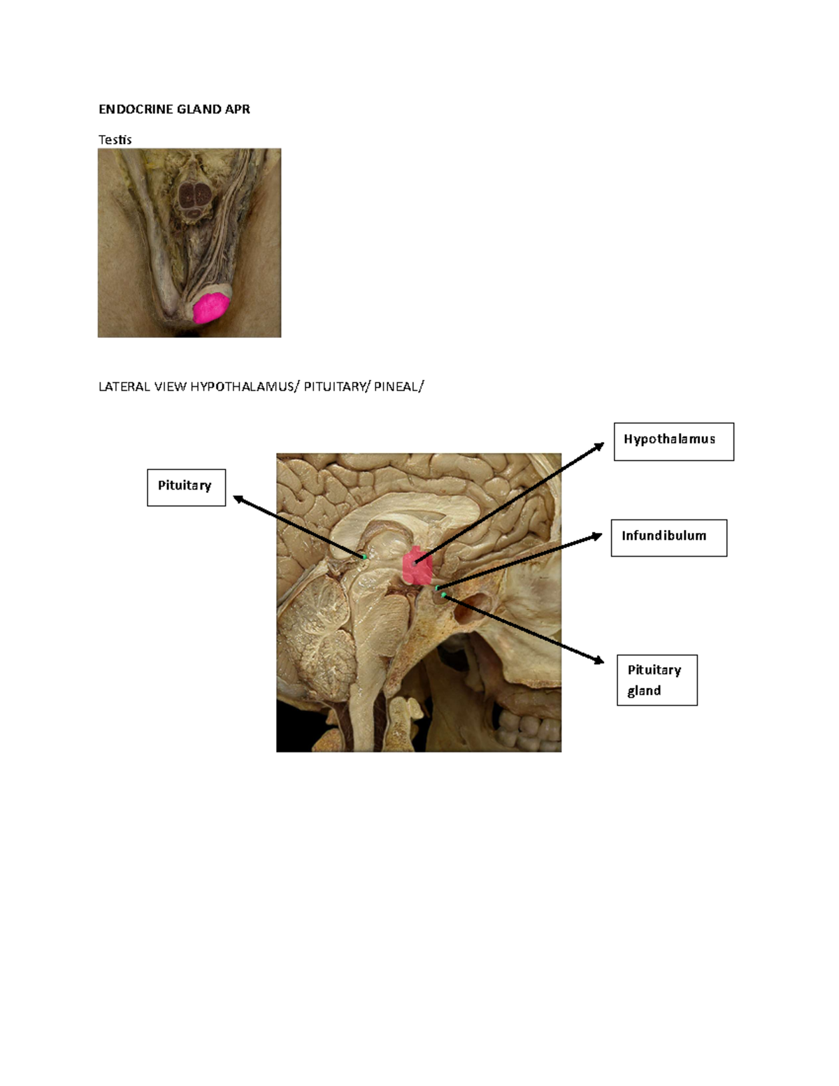 Anaphy LAB Reviewer Endocrine - ENDOCRINE GLAND APR TesƟs LATERAL VIEW ...