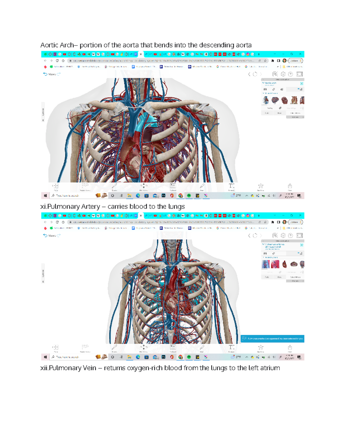 The Heart 1 Anatomy Lab - Aortic Portion Of The Aorta That Bends Into ...