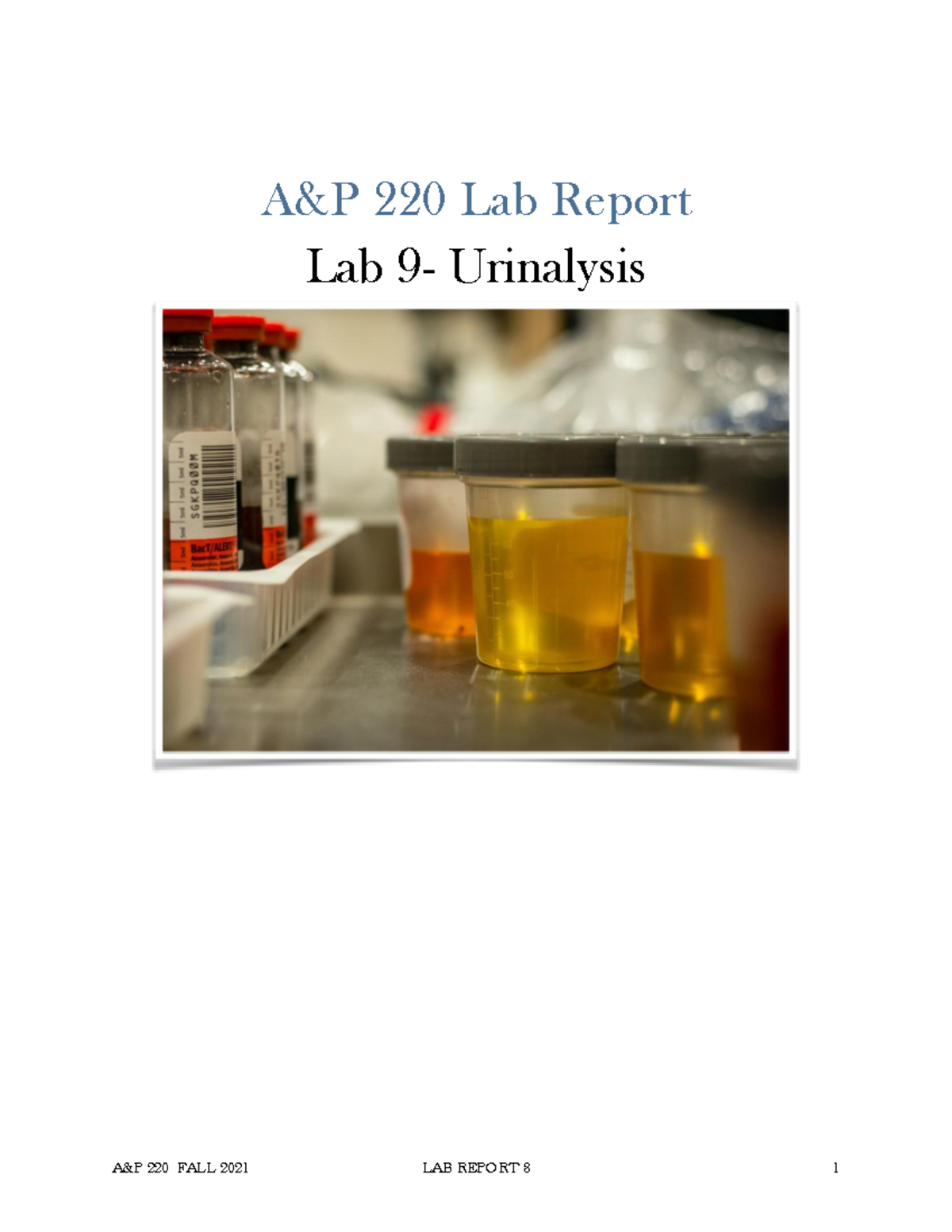 Lab 9 Urinalysis lab report 2021 A&P 220 Lab Report Lab 9 Urinalysis