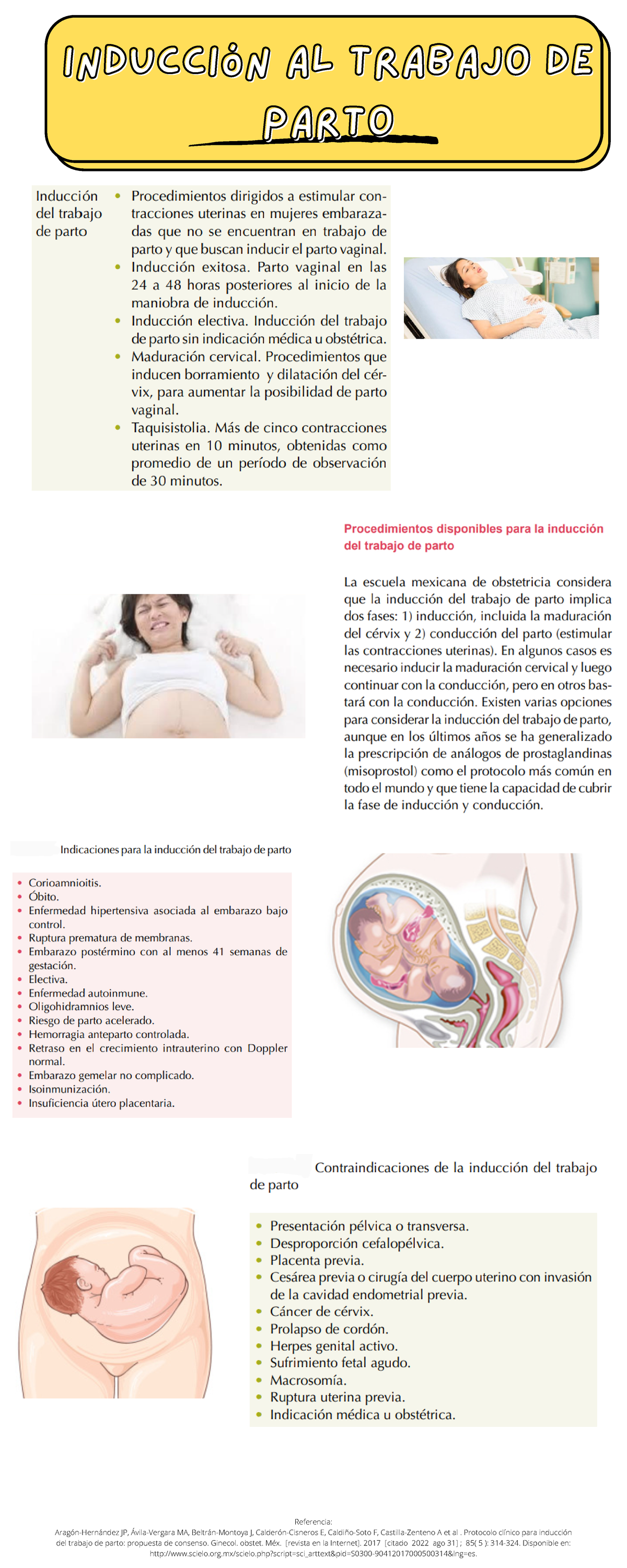 Inducción al trab. parto - Inducción al trabajo deInducción al trabajo ...
