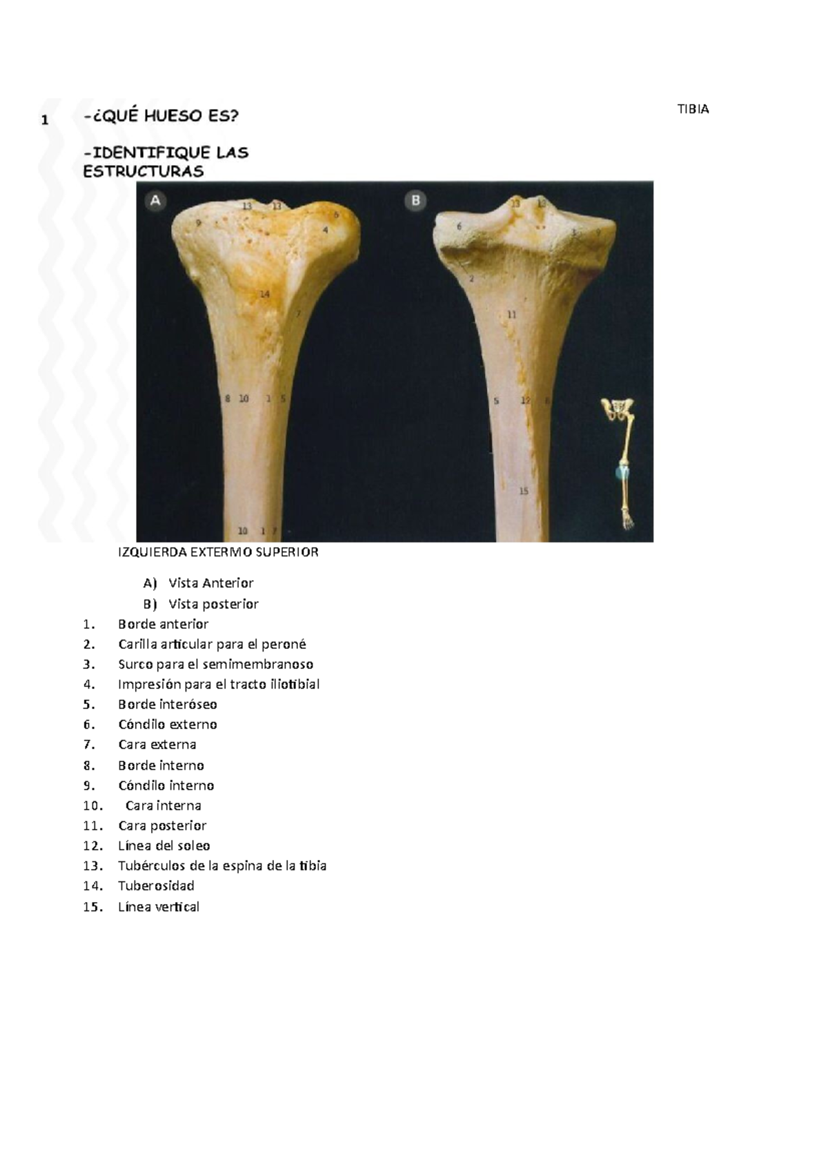 Tibia Izquierda Extermo Superior - TIBIA IZQUIERDA EXTERMO SUPERIOR A ...