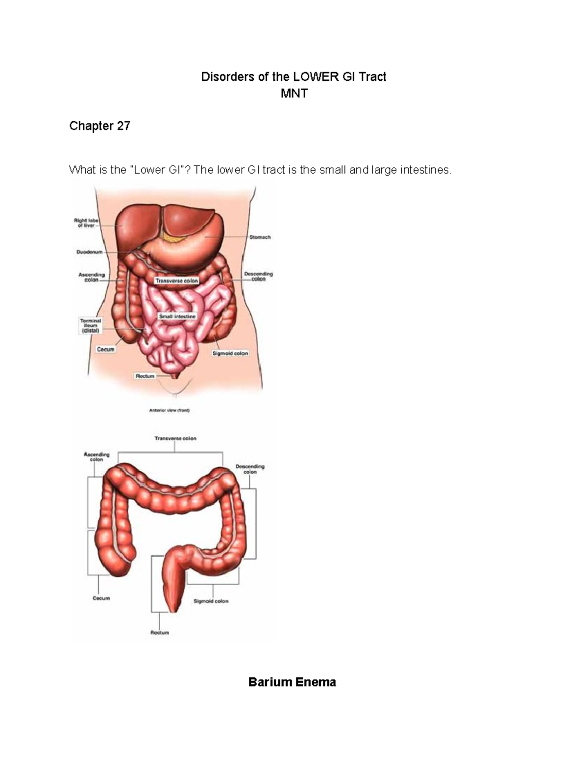 FNU 443 Chapter 27 Disorders of the Lower GI Tract - Disorders of the ...