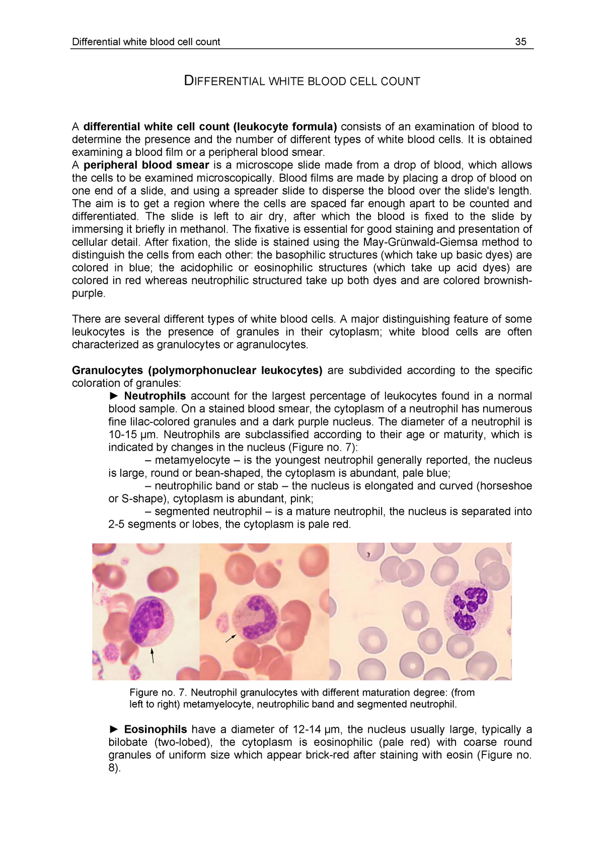 Leucocyte formula - Differential white blood cell count 35 DIFFERENTIAL ...