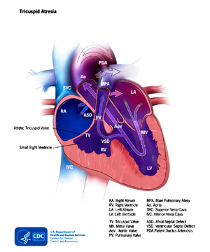 Mitral stenosis - 33Hz igure 1 PMVL LV AMVL LA JPEG rior mitral valve ...