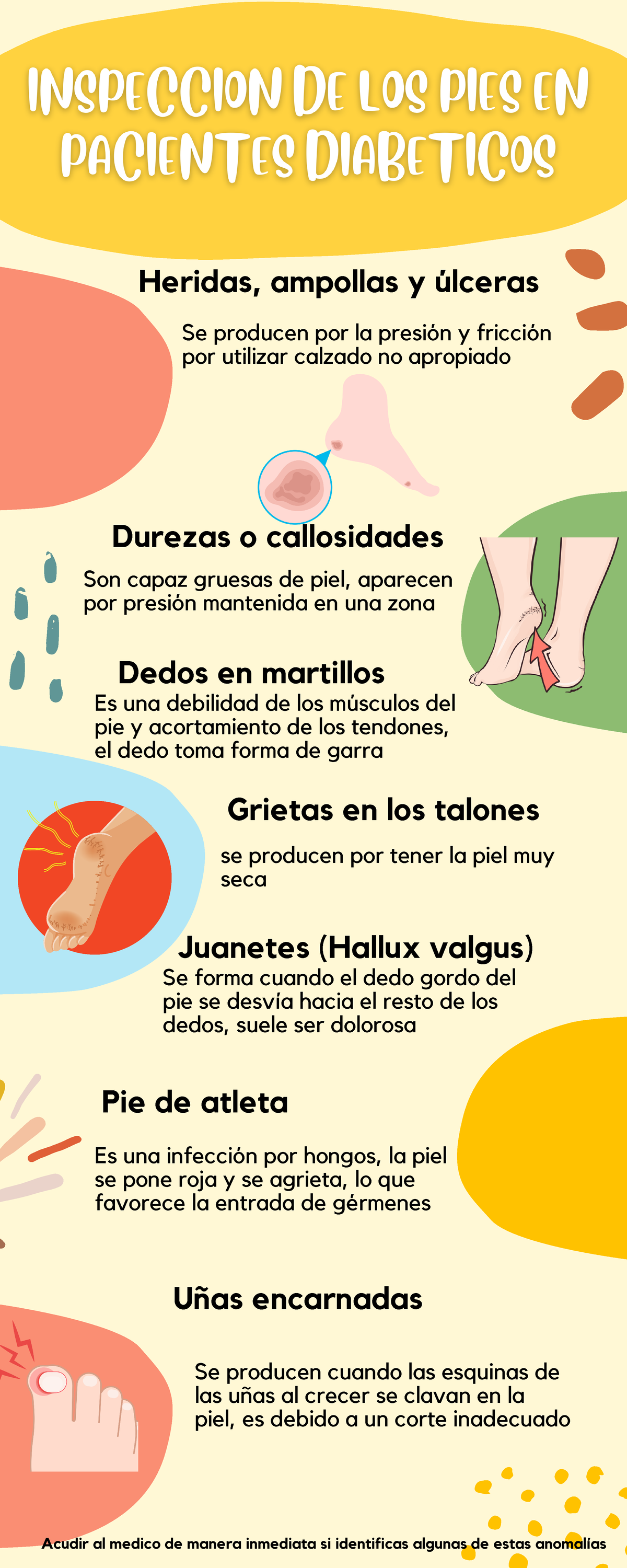 prevención de pie diabético Heridas, ampollas y úlceras Grietas en